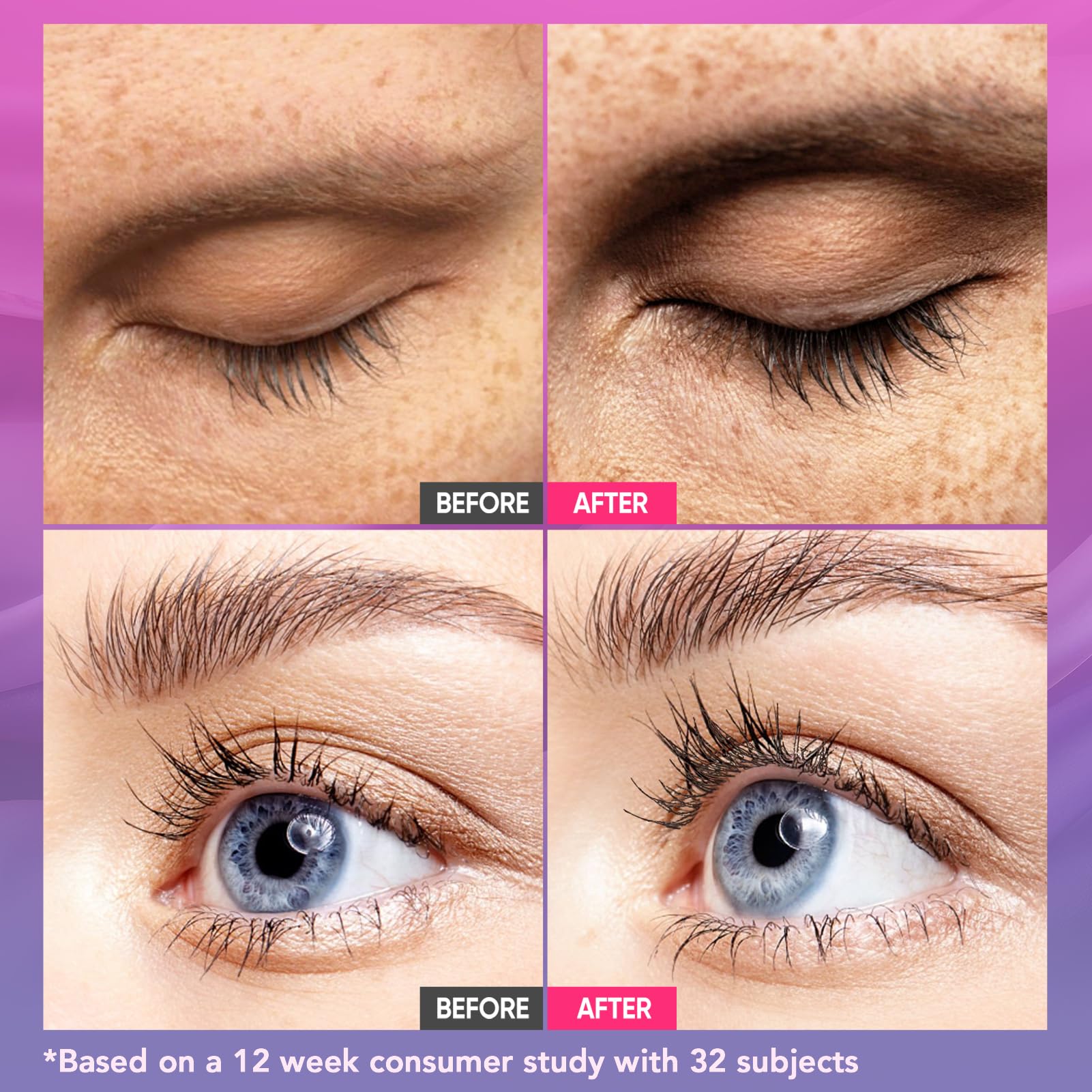 Eyelash Serum Lash Growth Enhancer: Advanced Natural Formula for Long Thickening Eyelashes - Safe for Sensitive Eyes 5ML Hormones Free - Medaid International