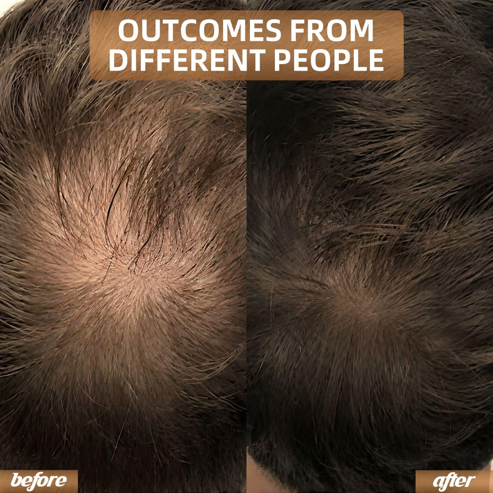 Red Light Therapy for Hair Growth, Laser Cap Hair Regrowth For Women and Men - Medaid International