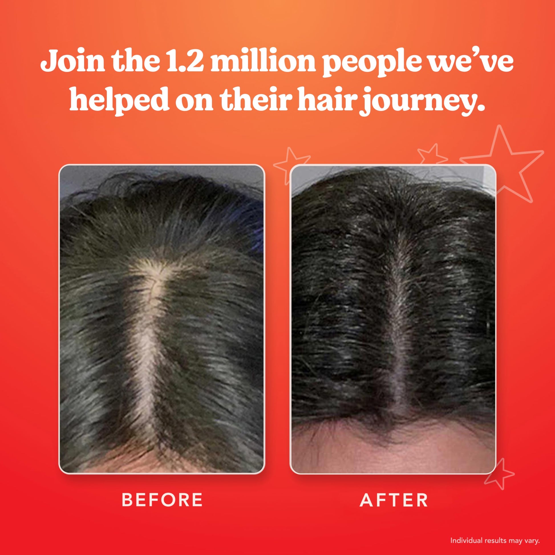 HAIRtamin Scalp Serum | Visibly Thicker, Nourished Hair and Healthy Scalp Treatment (Two Pack) - Medaid International