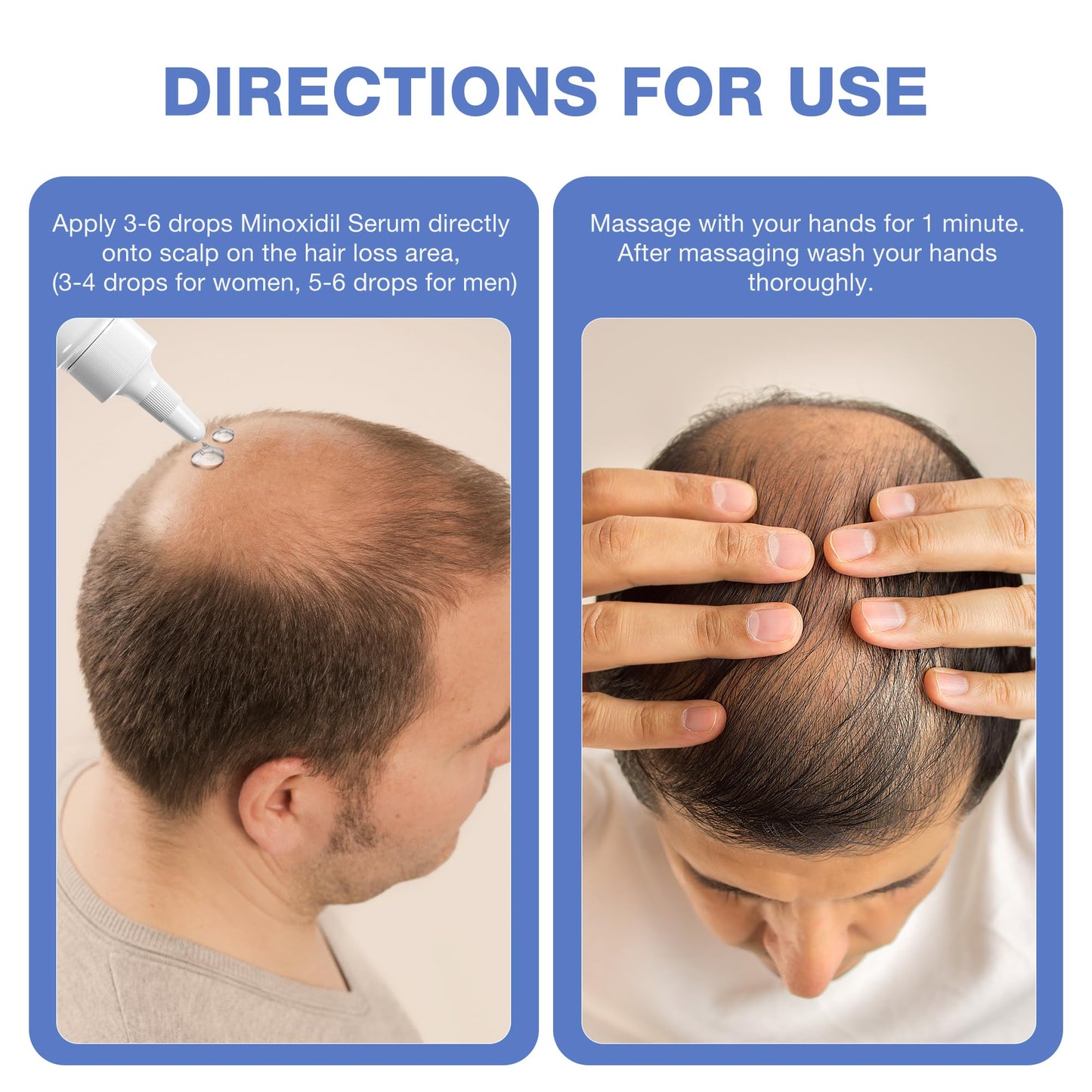 5% Minoxidil for Men, for Men & Women Hair with Biotin, Minoxidil for Beard Growth for Hair Loss to Hair Regrowth Get Thicker Fuller, Hair Loss Treatments for Women 100ml - Medaid International