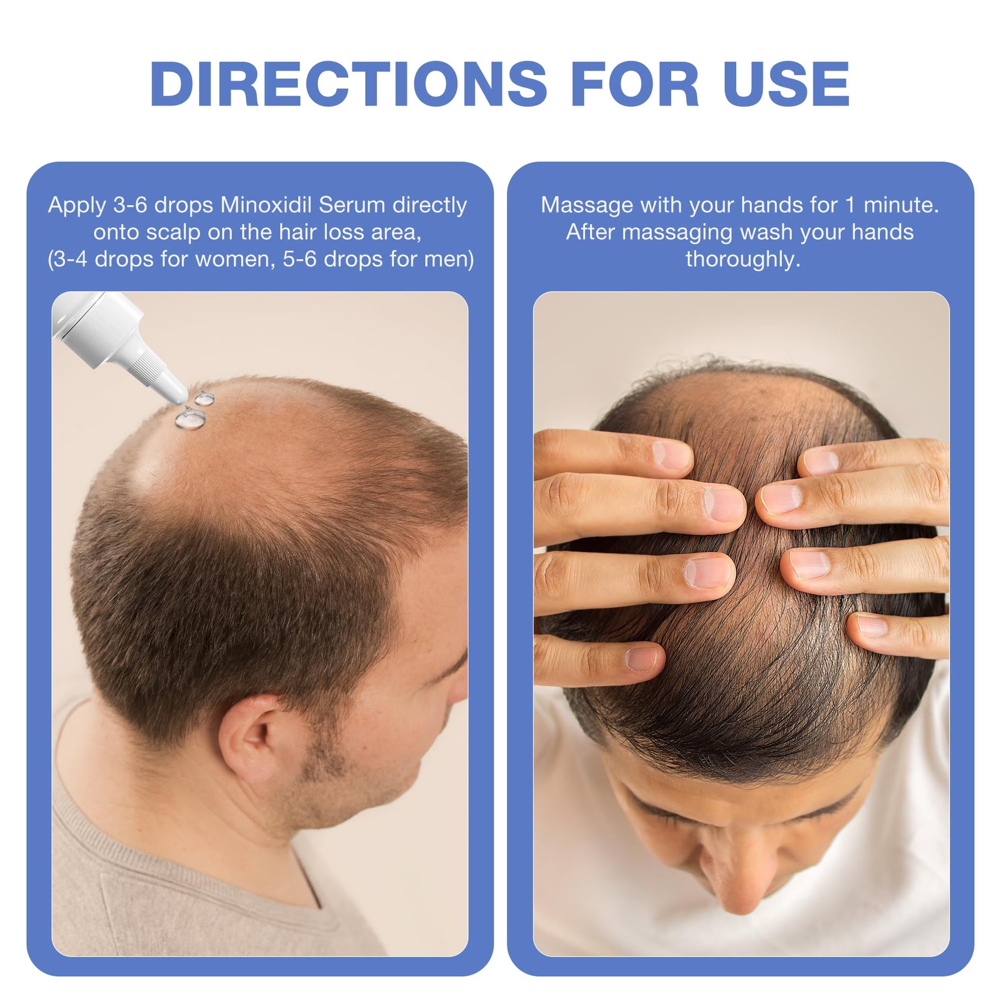 5% Minoxidil for Men, for Men & Women Hair with Biotin, Minoxidil for Beard Growth for Hair Loss to Hair Regrowth Get Thicker Fuller, Hair Loss Treatments for Women 100ml - Medaid International