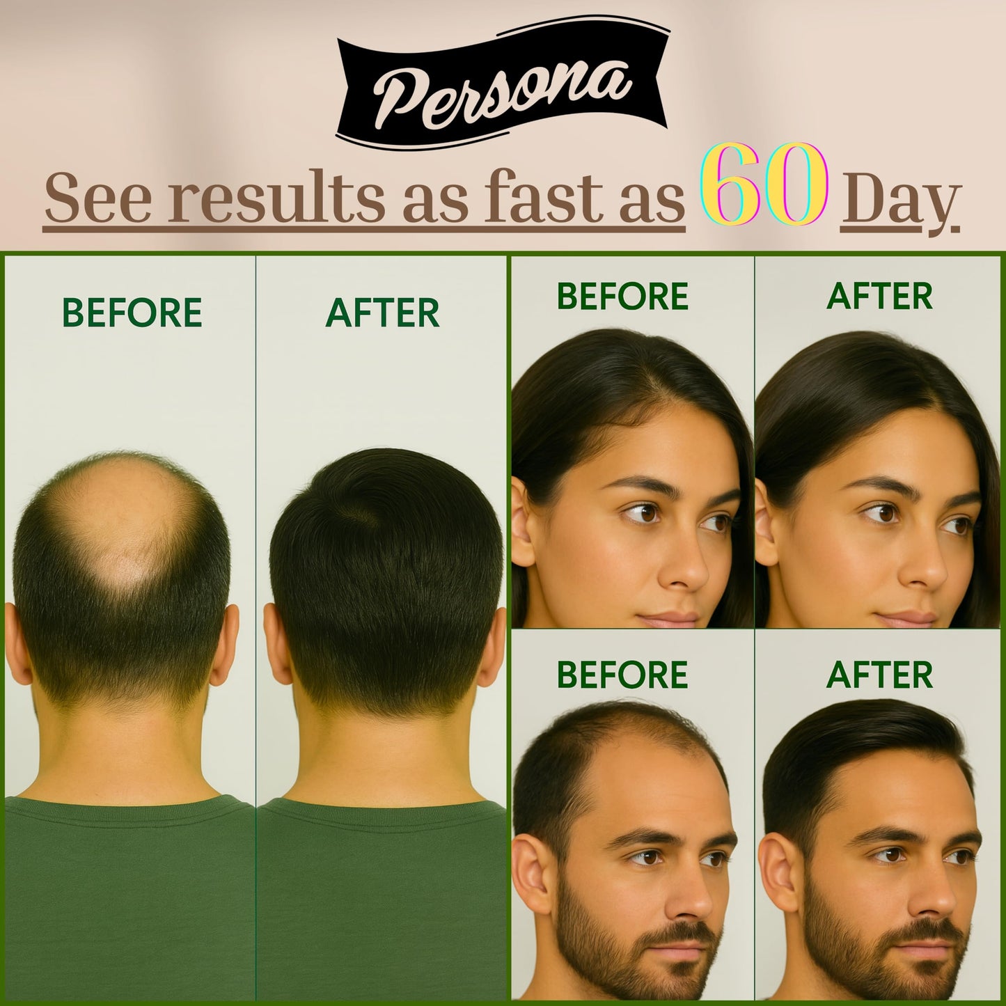 Hair Growth Serum – Advanced Biotin with Caffeine, Peptides, Botanical Extract for Thicker, Fuller, Longer Hair, Reduces Hair Thinning, Hair Regrowth Tonic, Hair Loss Treatment for Men & Women, 30ml - Medaid International