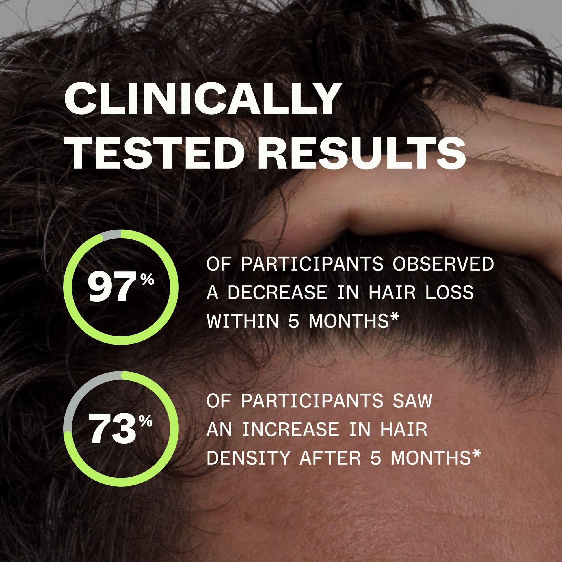 Scandinavian Biolabs Bio-Pilixin® Serum For Men | Helps Reduce Hair Loss Due to Breakage, Help Activate Hair Growth, Stem Cell Technology, Drug-Free Daily Use, Clinically Tested, 100 mL/ 3.4 Oz - Medaid International