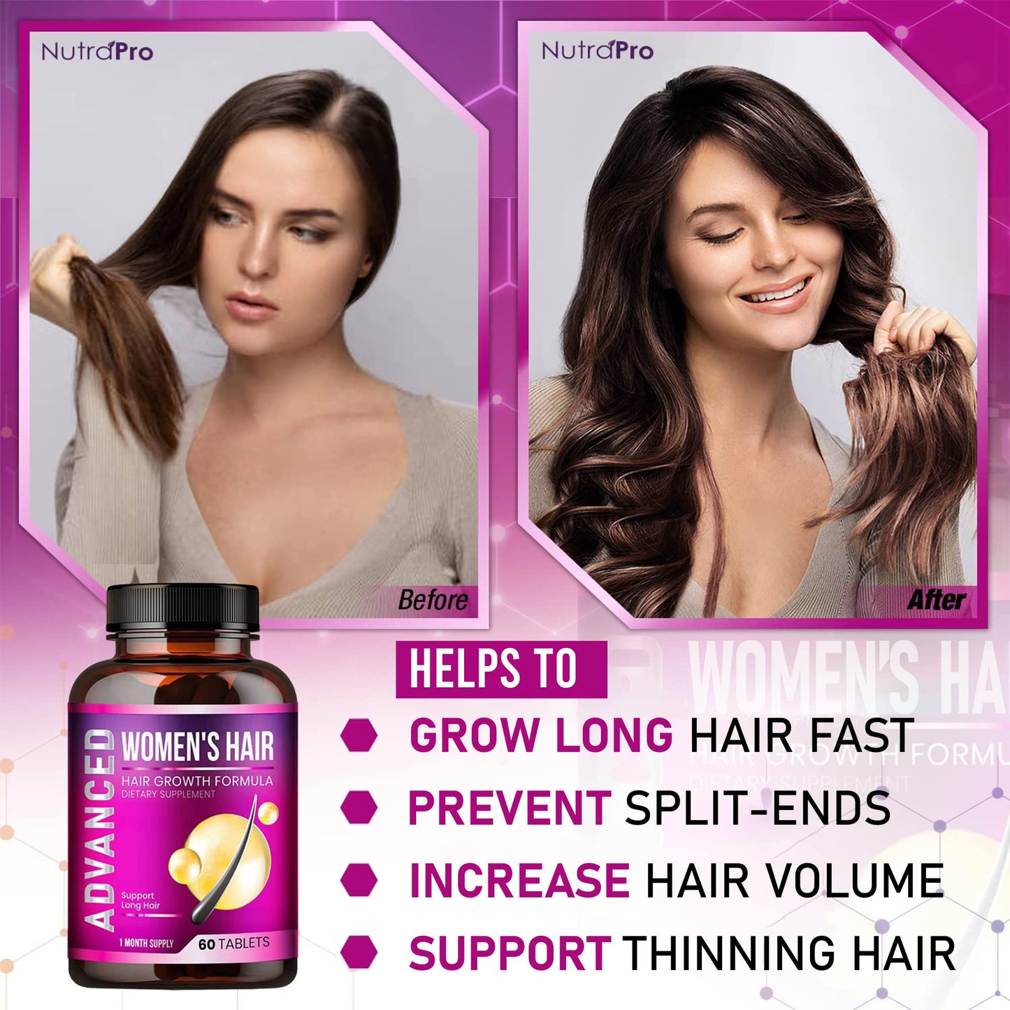 Hair Growth Vitamins for Women - Hair Vitamins for Thinning Hair for Women .Regrow & Regrowth Hair Supplement with Dht Blocker,Biotin & Saw Palmetto for Women.Volumize,Thicker,Longer Hair. - Medaid International