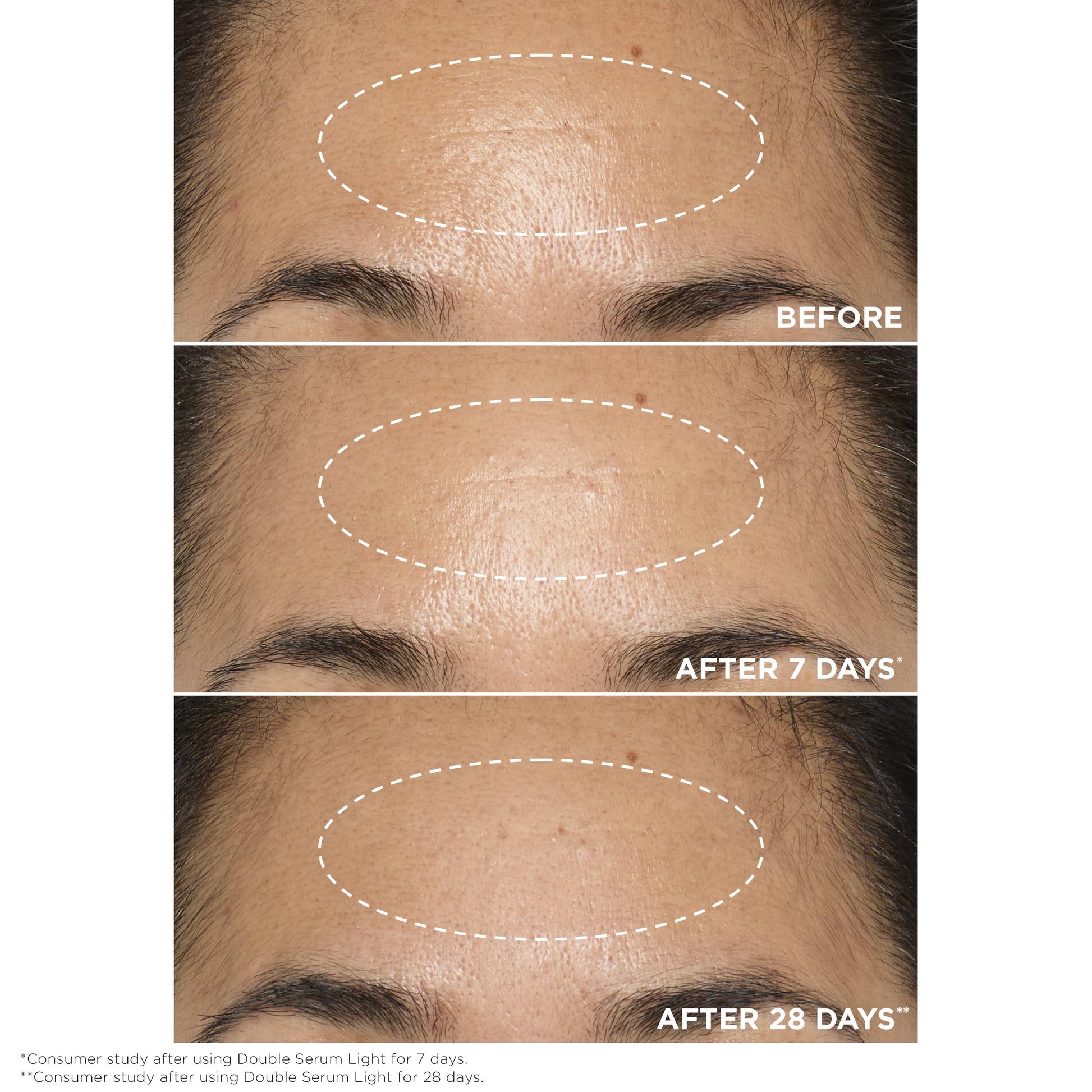 Clarins DOUBLE SERUM LIGHT TEXTURE | Anti Aging Serum | Visibly Firms, Smoothes, Boosts Radiance and Refines Pores | 24H Hydration | Great for Combination to Oily Skin and Humid Climates, 1.7 Fl oz - Medaid International