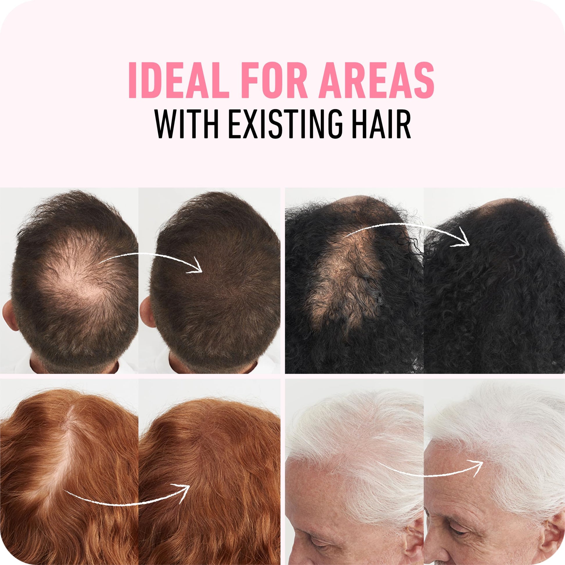 BOLDIFY Hair Fibers (56g) - Fill In Thinning and Fine Hair for an Instantly Fuller, Thicker Look - 14 Shades for Women & Men - Dark Brown - Medaid International