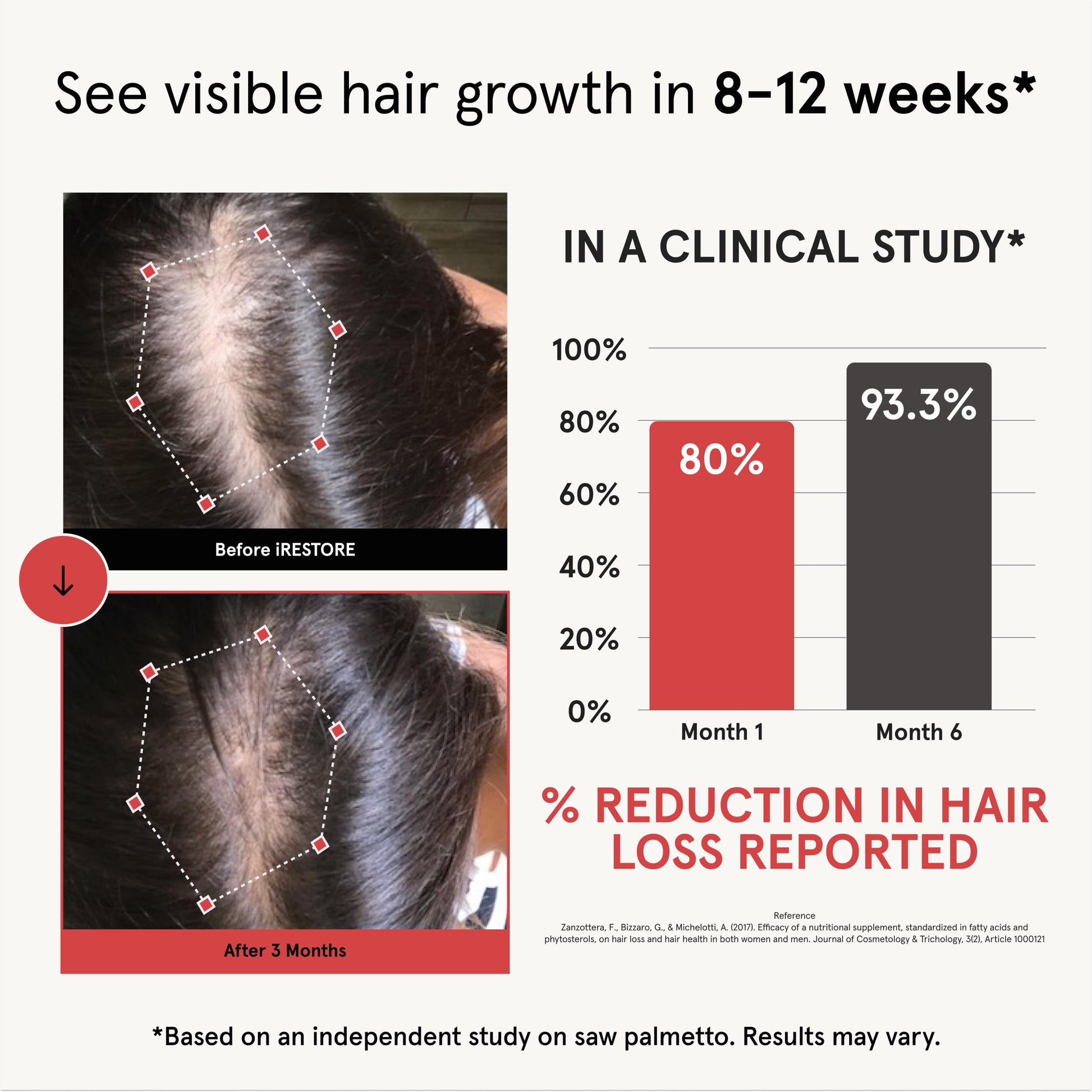 Fuller, Healthier Hair Kit: Hair Growth Supplement & Essential Hair Device - Medaid International