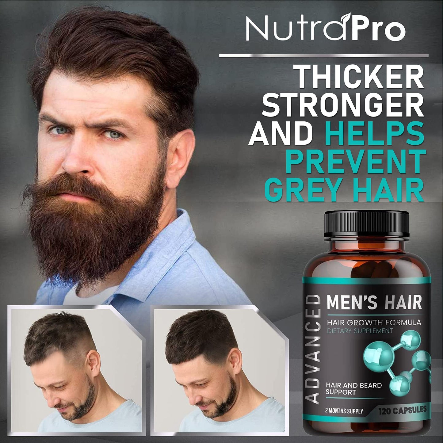 Hair Growth Vitamins For Men - Anti Hair Loss Pills. Regrow Hair & Beard Growth Supplement For Volumize, Thicker Hair.Stop Hair Loss And Thinning Hair With Biotin & Saw Palmetto Hair Vitamins.120 Caps - Medaid International