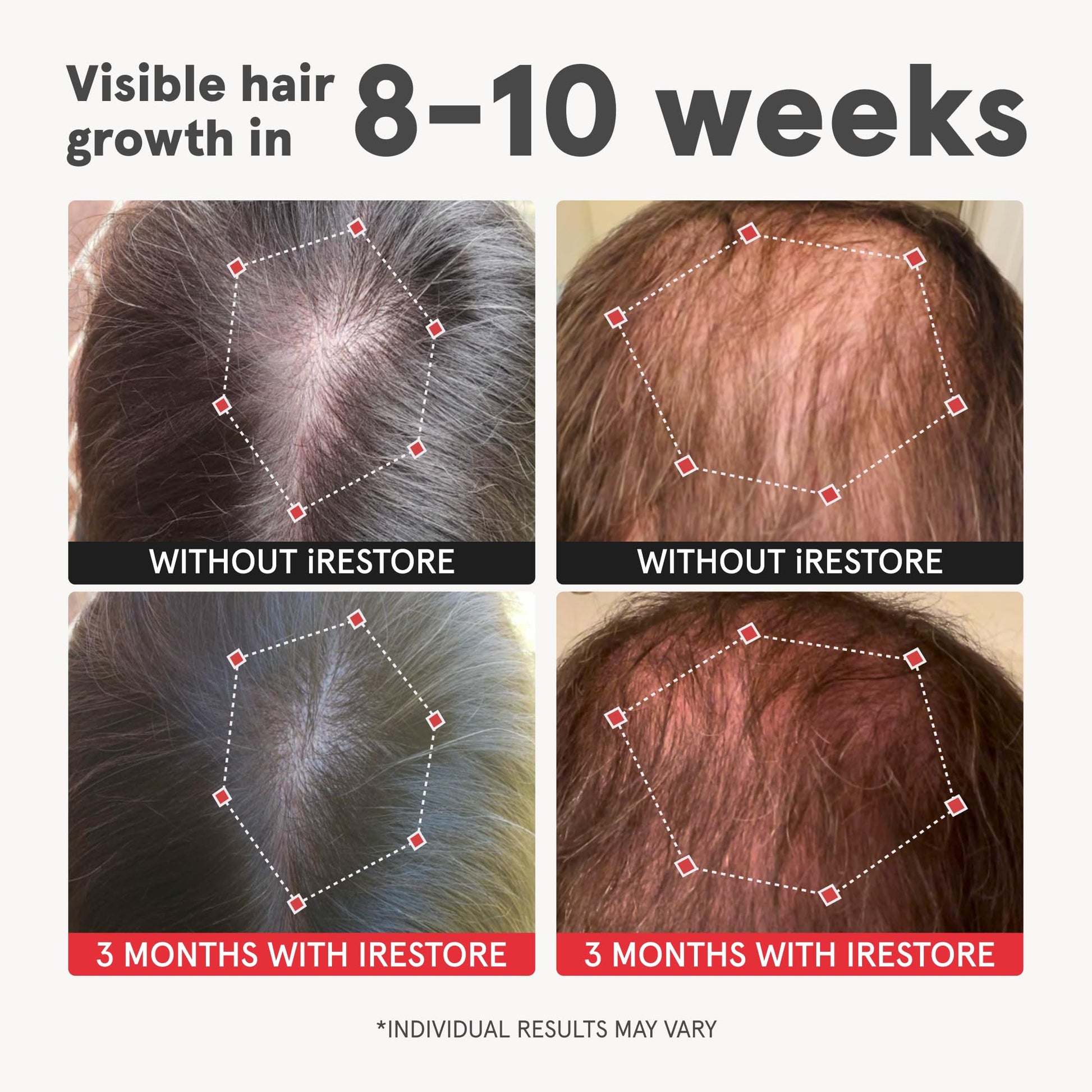 Hair Boost System Bundle: Advanced Hair Growth Supplement + Pro Hair Device - Medaid International