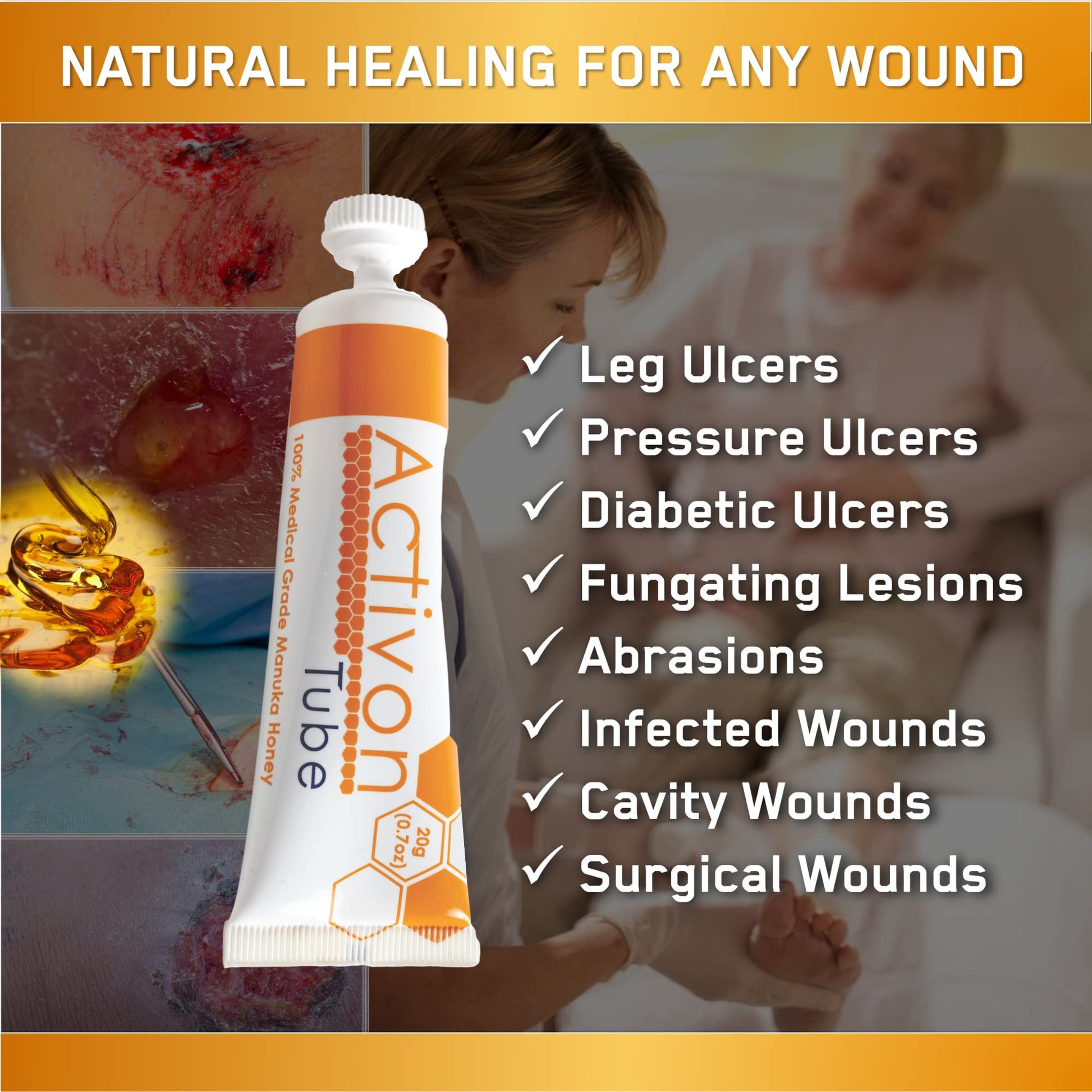 Activon Medical Grade 100% Manuka Honey Gel Tube Natural Healing of Wounds 20g Pack of 1 - Medaid International