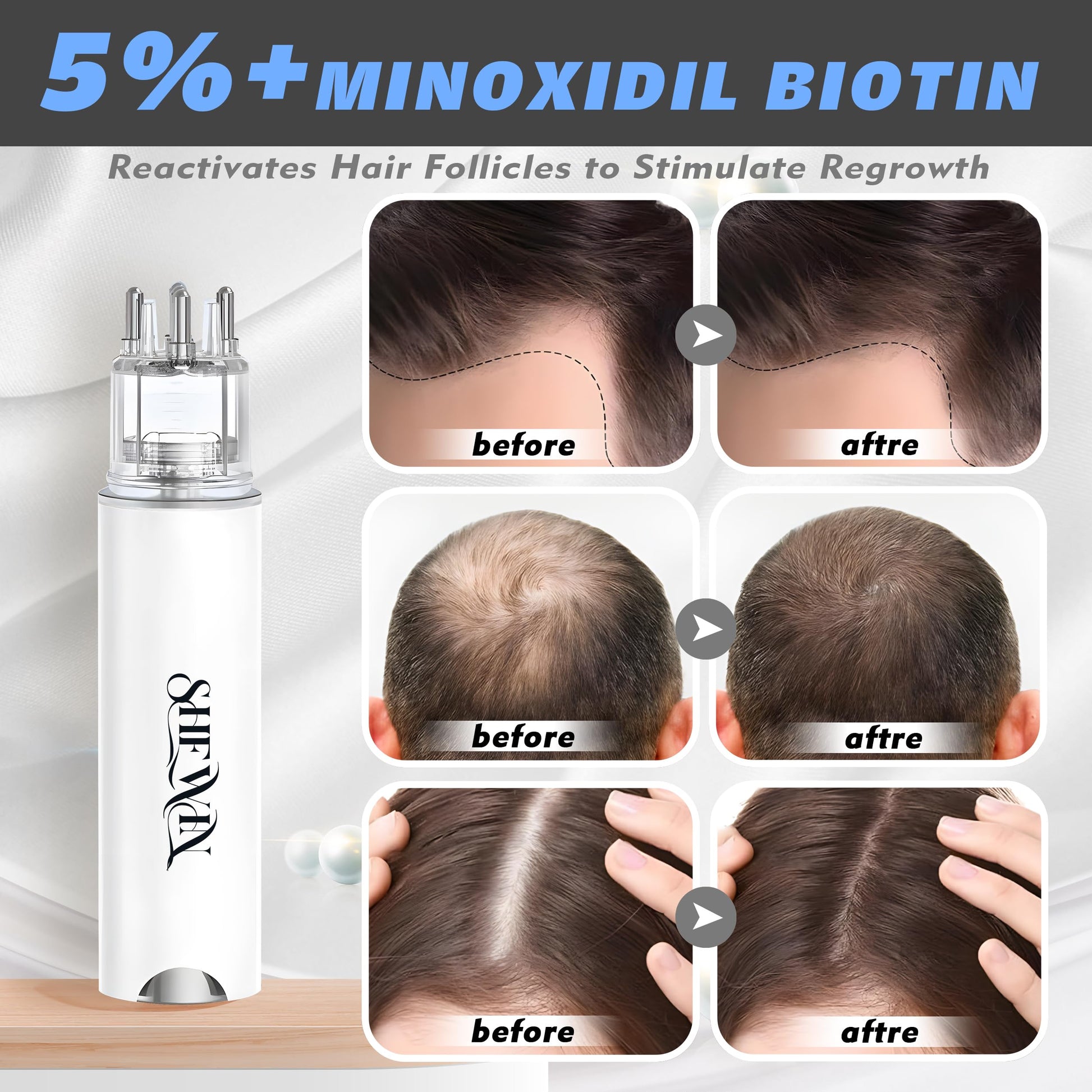 Hair Growth Serum Minoxidil Applicator - 2 in 1 Scalp Applicator with 5% Biotin Growth Oil Non-Greasy for Women Men Hair Regrowth (15ML, Unscented) - Medaid International