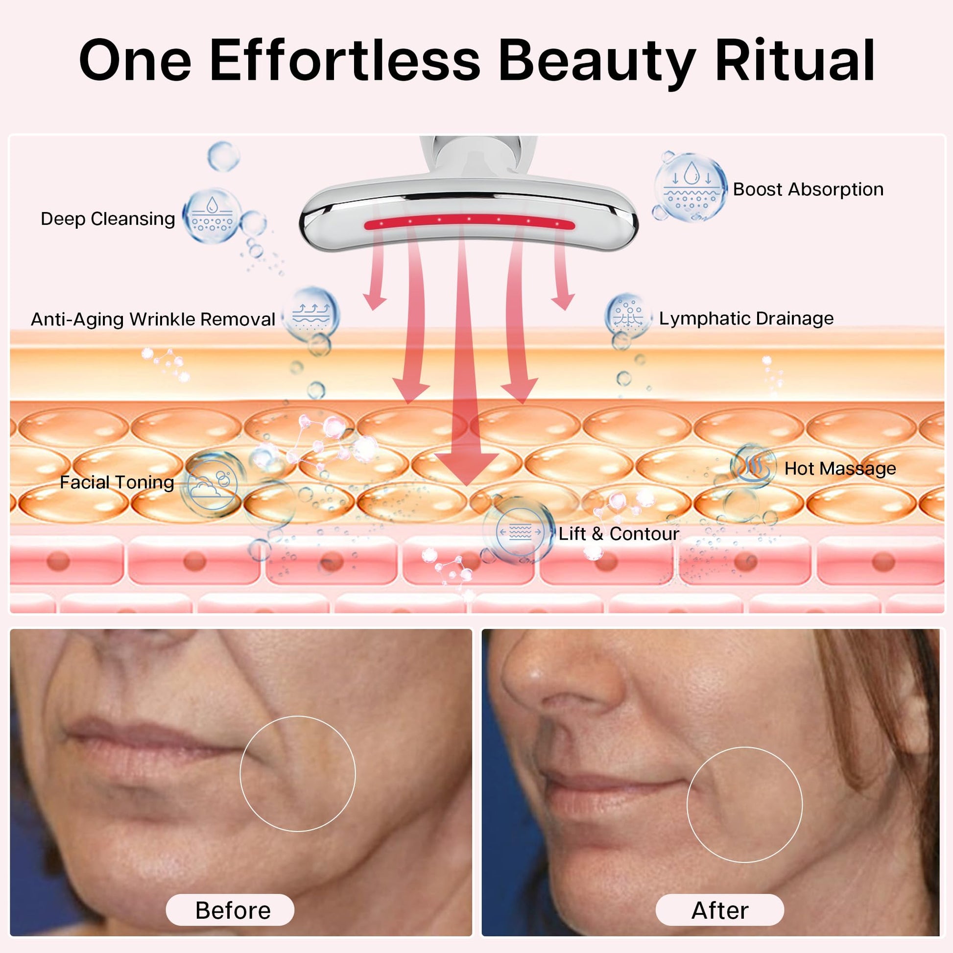 VRAIKO Lilac 7-in-1 Beauty Massager for Face and Neck - Jawline Lifting & Firming - Face Lymphatic Drainage Massager for Anti Aging Wrinkle, Forehead Lines, and Dark Circles, White - Medaid International