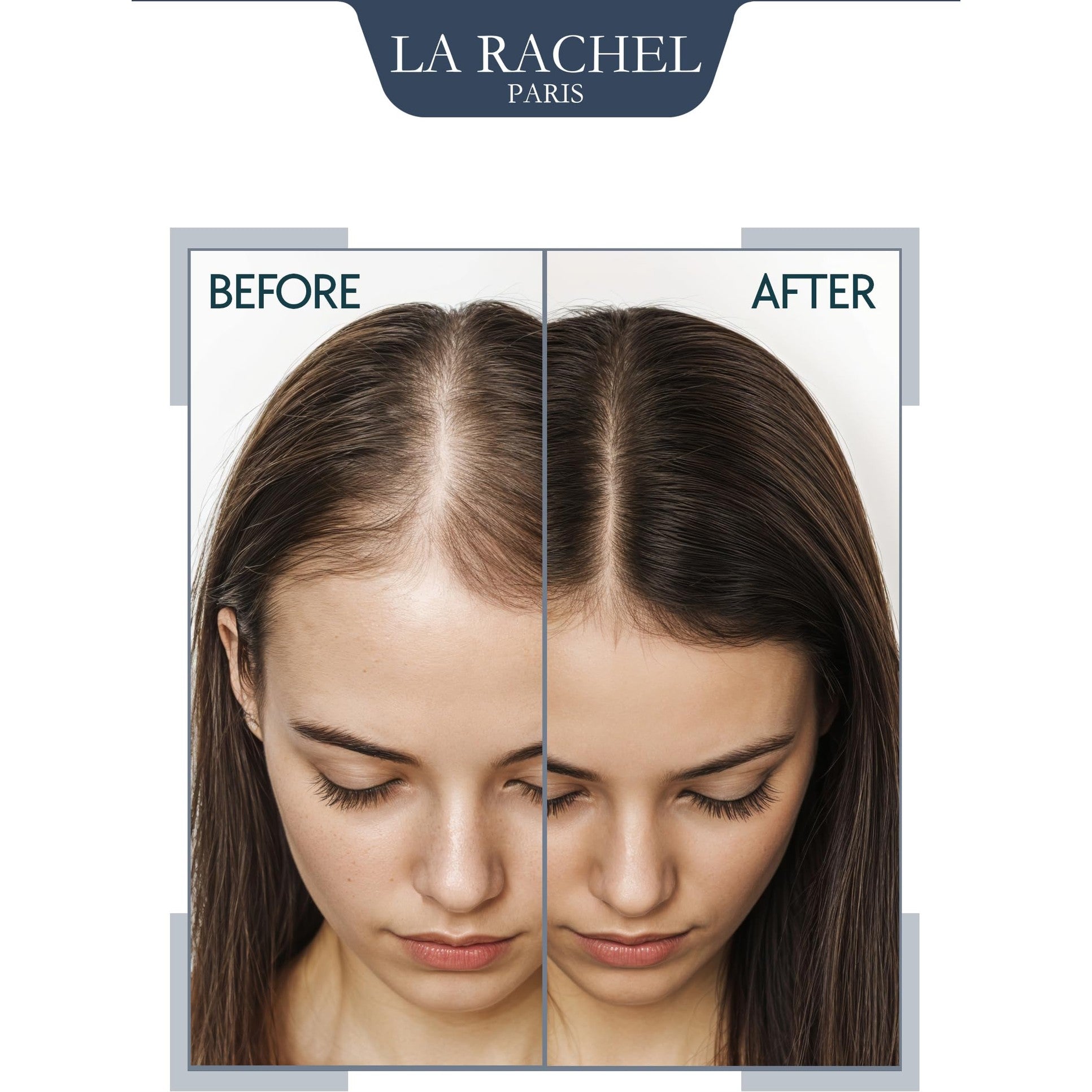 Anti-Hair Loss Tonic with Biotin, Panthenol & Caffeine | Hair Growth Treatment for Men and Women | Scientifically Proven Formula to Strengthen and Revitalize Thinning Hair by La Rachel Paris - Medaid International