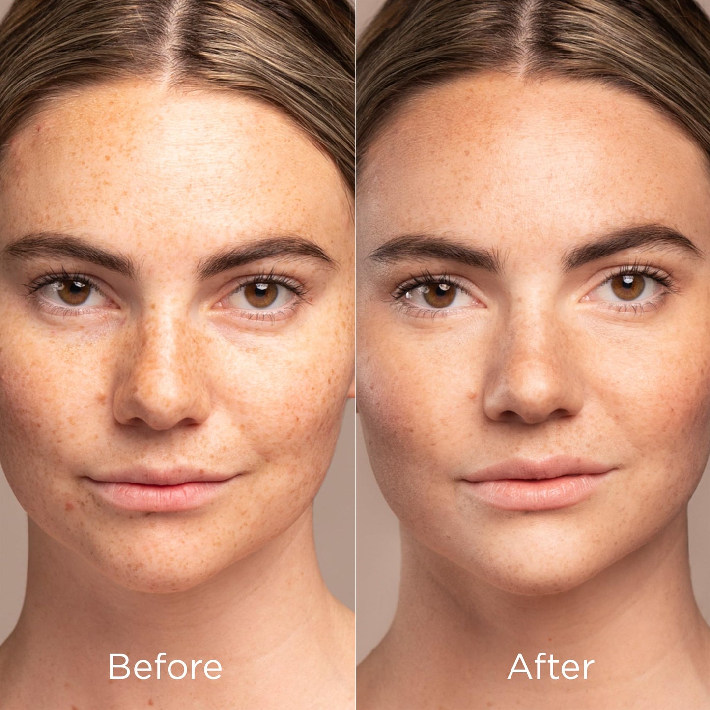 IMAGE Skincare, PREVENTION+ Sun Serum SPF 30 Mineral Sunscreen for Face, Non Comedogenic, Wear Under Makeup, Perfect Travel Size, 1.0 oz - Medaid International