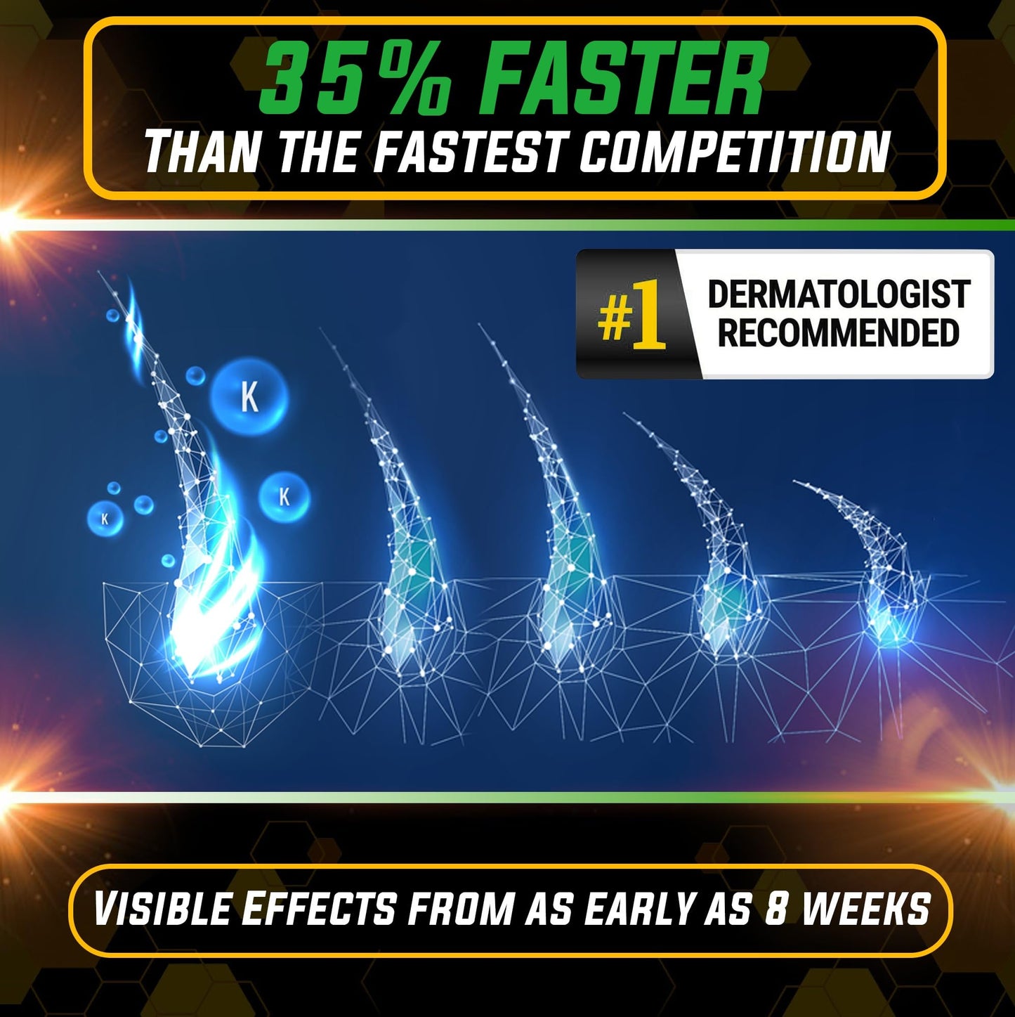 Elevate Hair Regrowth Treatment 5% Minoxidil Spray - Extra Strength Formula Professional Treatment for Hair Loss and Thinning for Regrowth - Stimulate Follicles for Men and Women 1 Month Supply - Medaid International