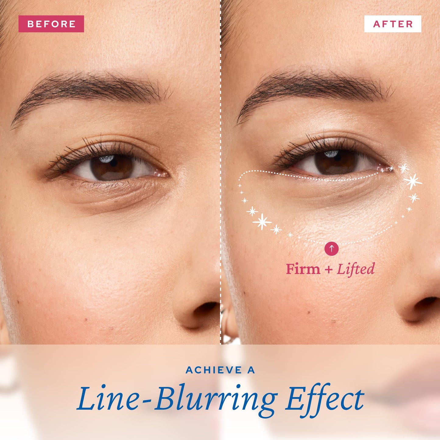 belif Retinol Firming Eye Serum – Aqua Bomb Lifting Eye Gel with Collagen & Bakuchiol for Puffiness, Fine Lines & Wrinkles, Peptide & Hyaluronic Acid, Korean Skin Care - Medaid International