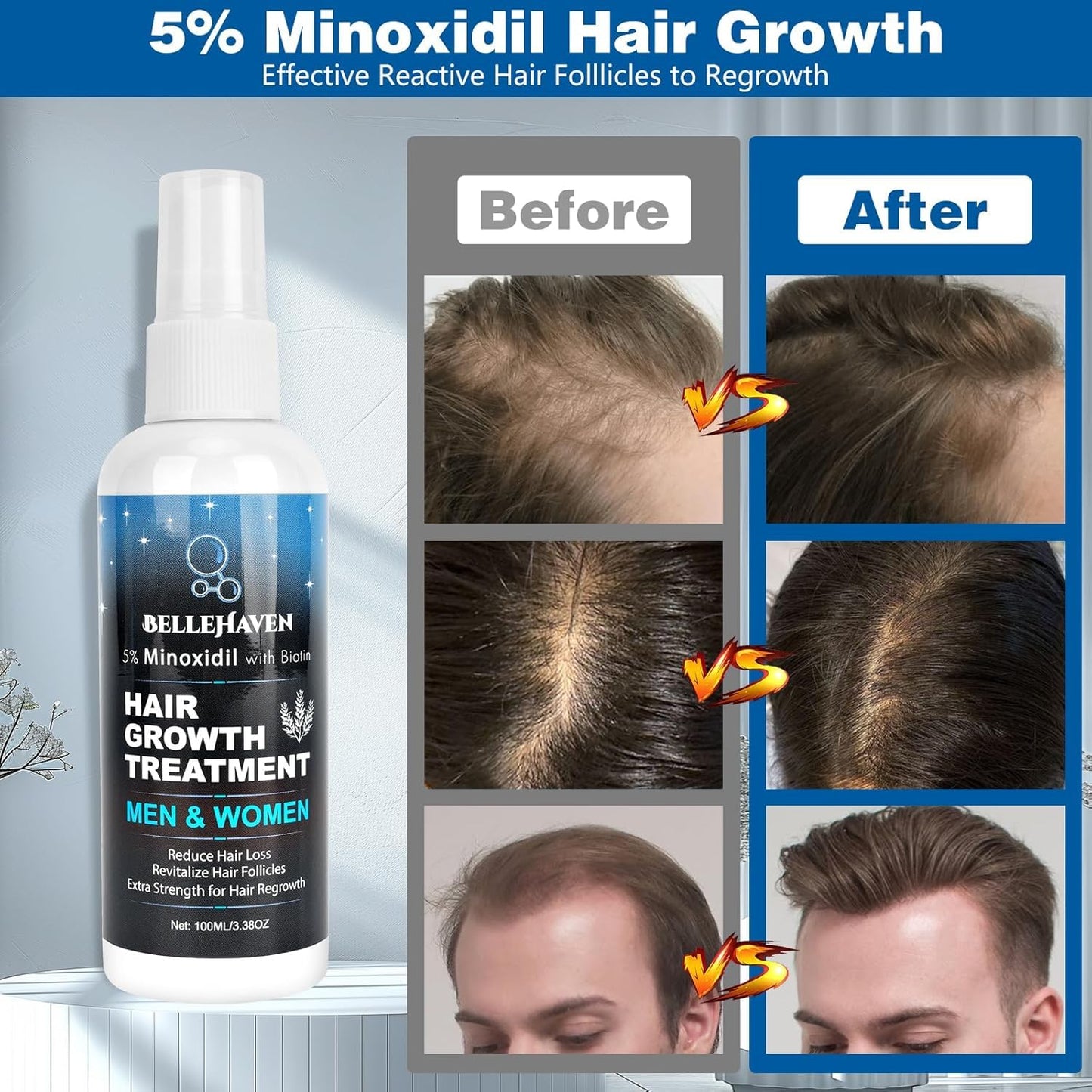 5% Minoxidil for Men Women, 100ML Minoxidil Hair Growth, Hair Regrowth Treatment Spray, Minoxidil Topical Solution Hair Growth Serum Stop Thinning and Loss Hair 2 Month Supply, for Beard, Hair - Medaid International
