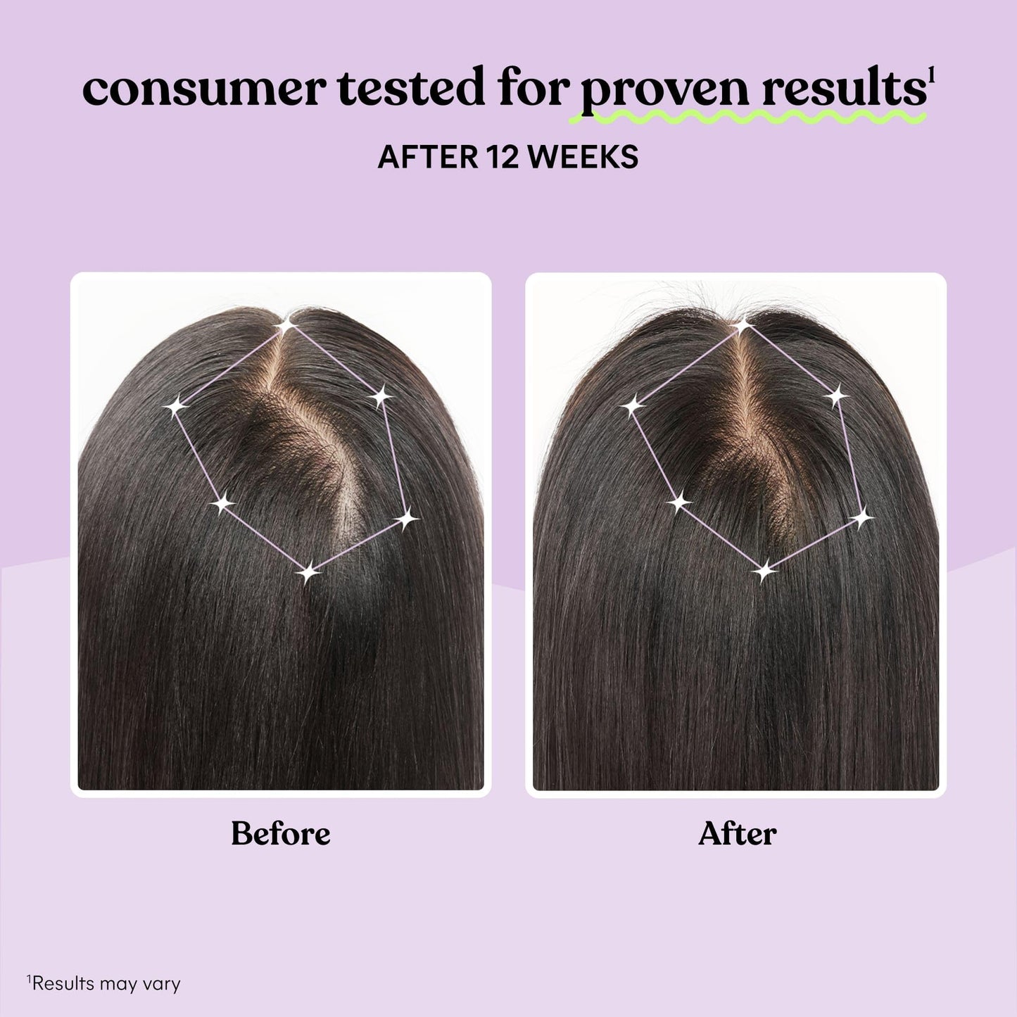 Lemme Grow Hair Growth Supplement for Women, Clinically Proven Keratin Complex for Visibly Thicker Hair and Scalp Coverage, Reduced Shedding, Nourish Thinning Hair - 1 Month Supply - Medaid International