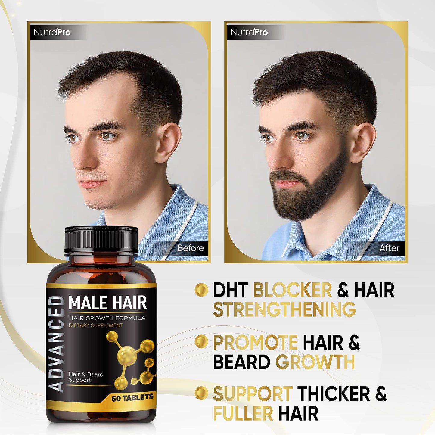 Hair Growth Vitamins For Men-Anti Hair Loss Support Vitamins Pills & Dht Blocker For Men.Regrow Hair & Beard Growth Supplement For Thicker Fuller & Stronger Hair. Support Thinning Hair With Biotin. - Medaid International