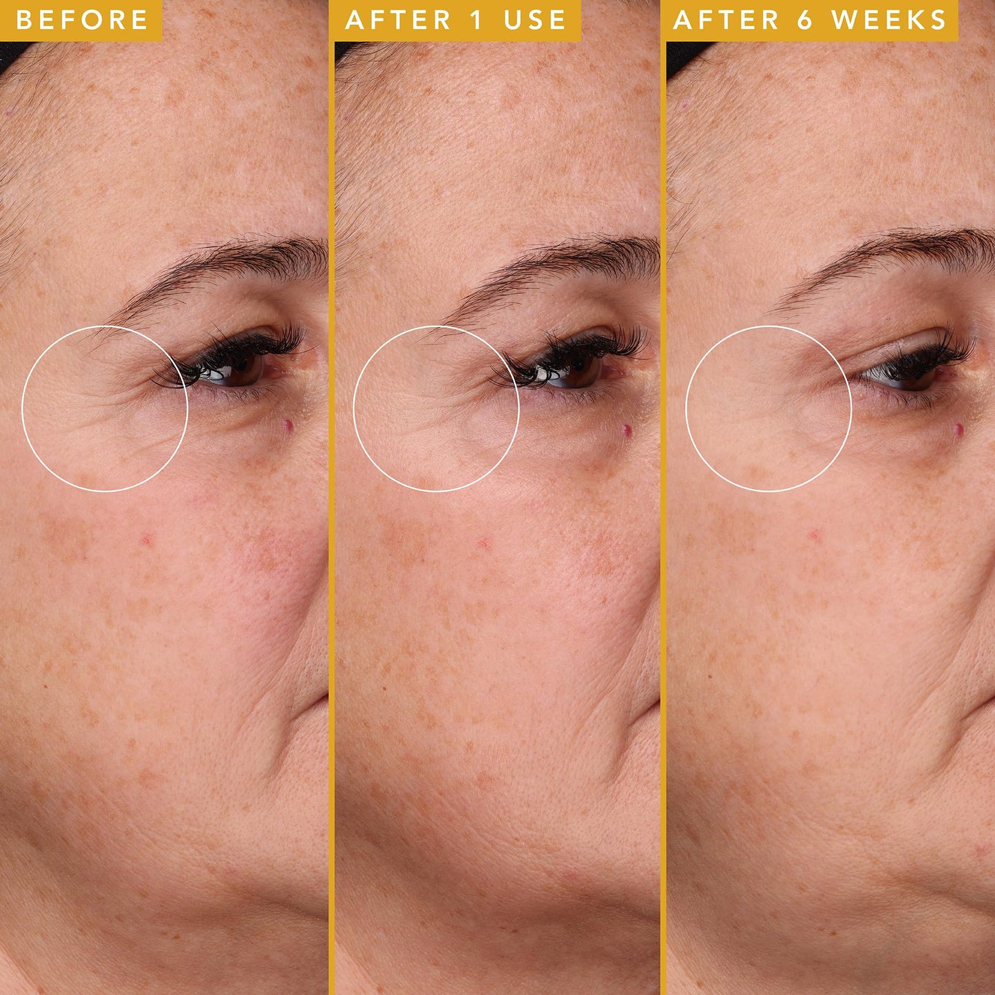 Farmacy Hyaluronic Acid Serum for Face - Filling Good Anti Aging Skin Care + Hydrating Face Serum - Plumping + Smoothing Wrinkle Serum to Visibly Firm Skin for a Youthful Complexion (30ml) - Medaid International