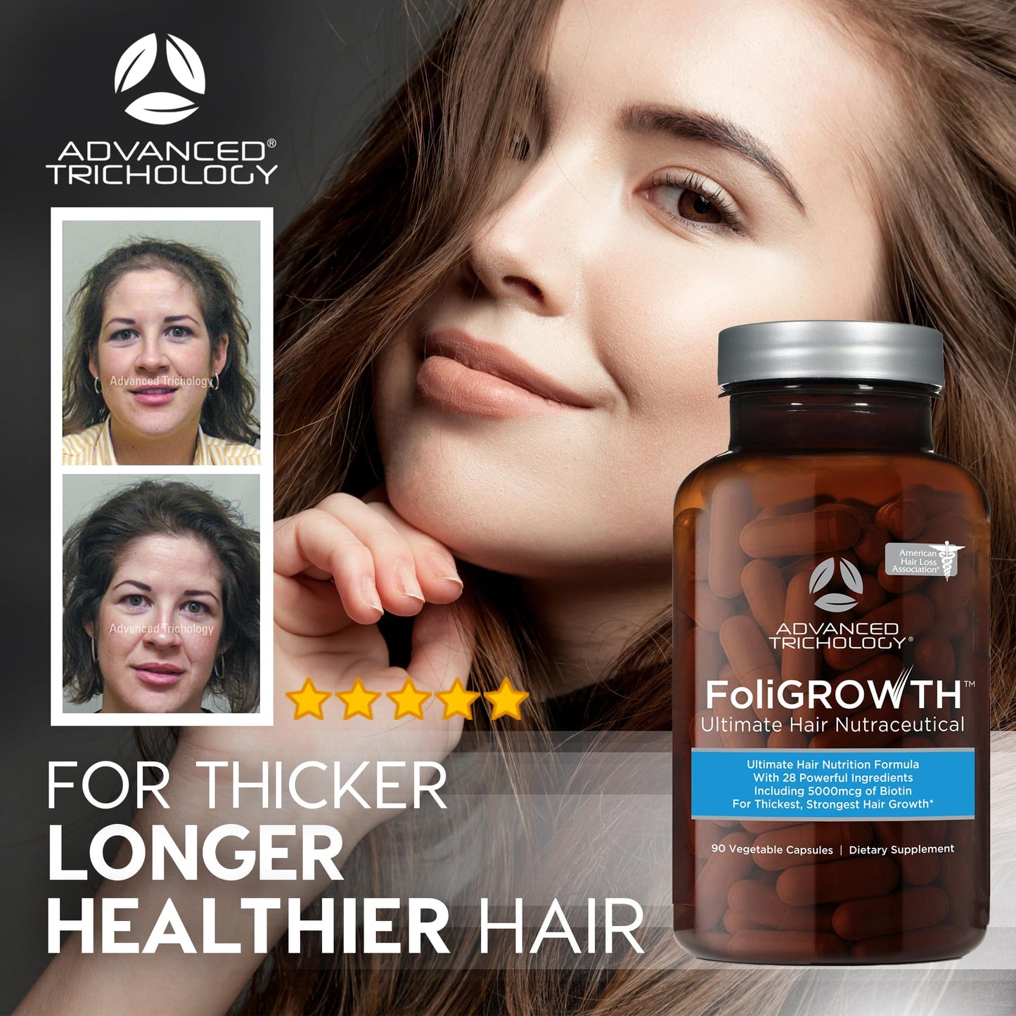 Advanced Trichology FoliGROWTH™ Hair Growth Supplement for Thicker Fuller Hair | Approved* by the American Hair Loss Association | Revitalize Thinning Hair - 90 Count (Pack of 1) - Medaid International