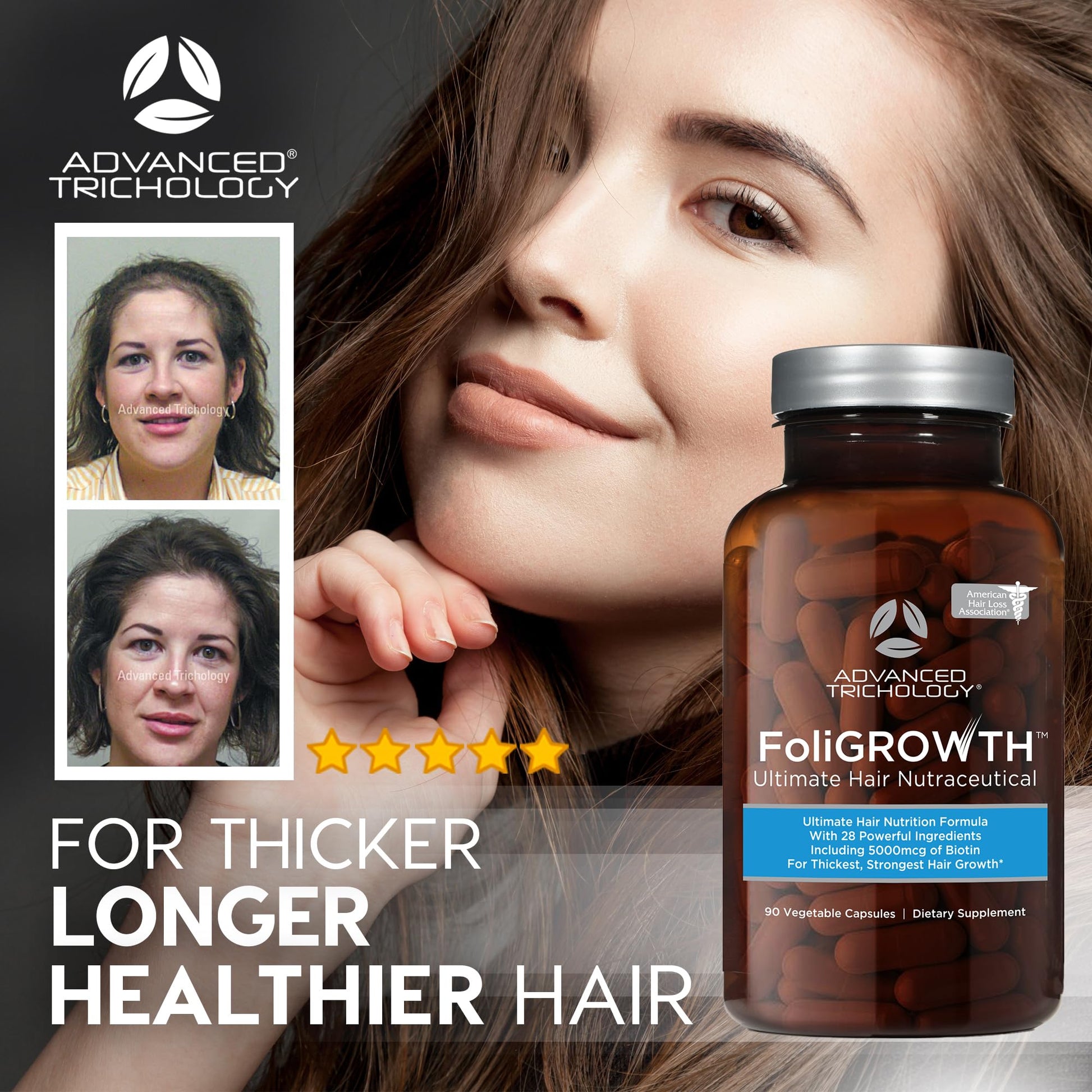 Advanced Trichology FoliGROWTH™ Hair Growth Supplement for Thicker Fuller Hair | Approved* by the American Hair Loss Association | Revitalize Thinning Hair - 90 Count (Pack of 1) - Medaid International