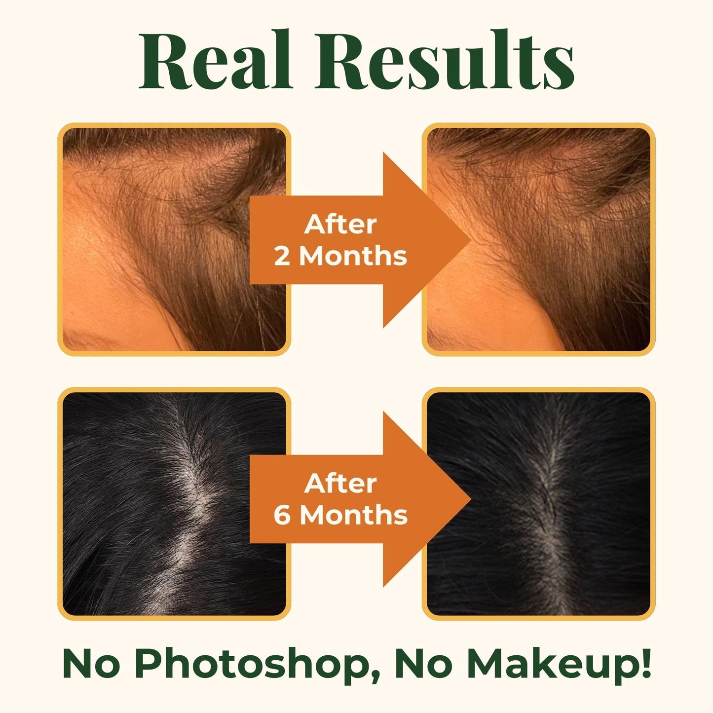 Heebin's Hair Growth Supplements with Biotin 4000 mcg, DHT Blocker and Collagen, for Hair Loss, Thinning and Regrowth, 60 Tablets, 2 Month Supply - Medaid International