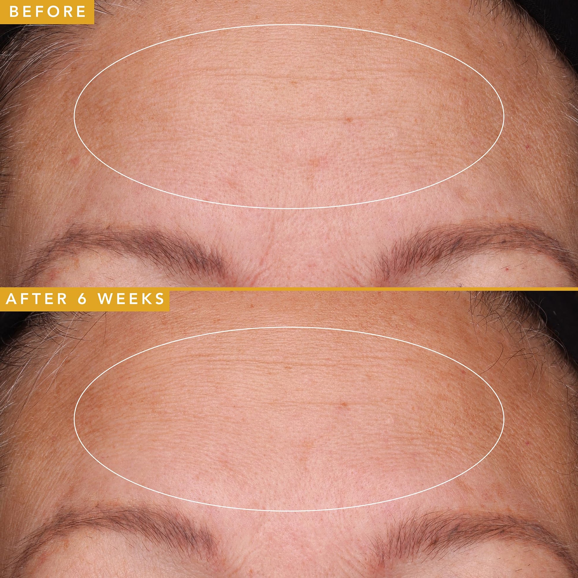 Farmacy Hyaluronic Acid Serum for Face - Filling Good Anti Aging Skin Care + Hydrating Face Serum - Plumping + Smoothing Wrinkle Serum to Visibly Firm Skin for a Youthful Complexion (30ml) - Medaid International