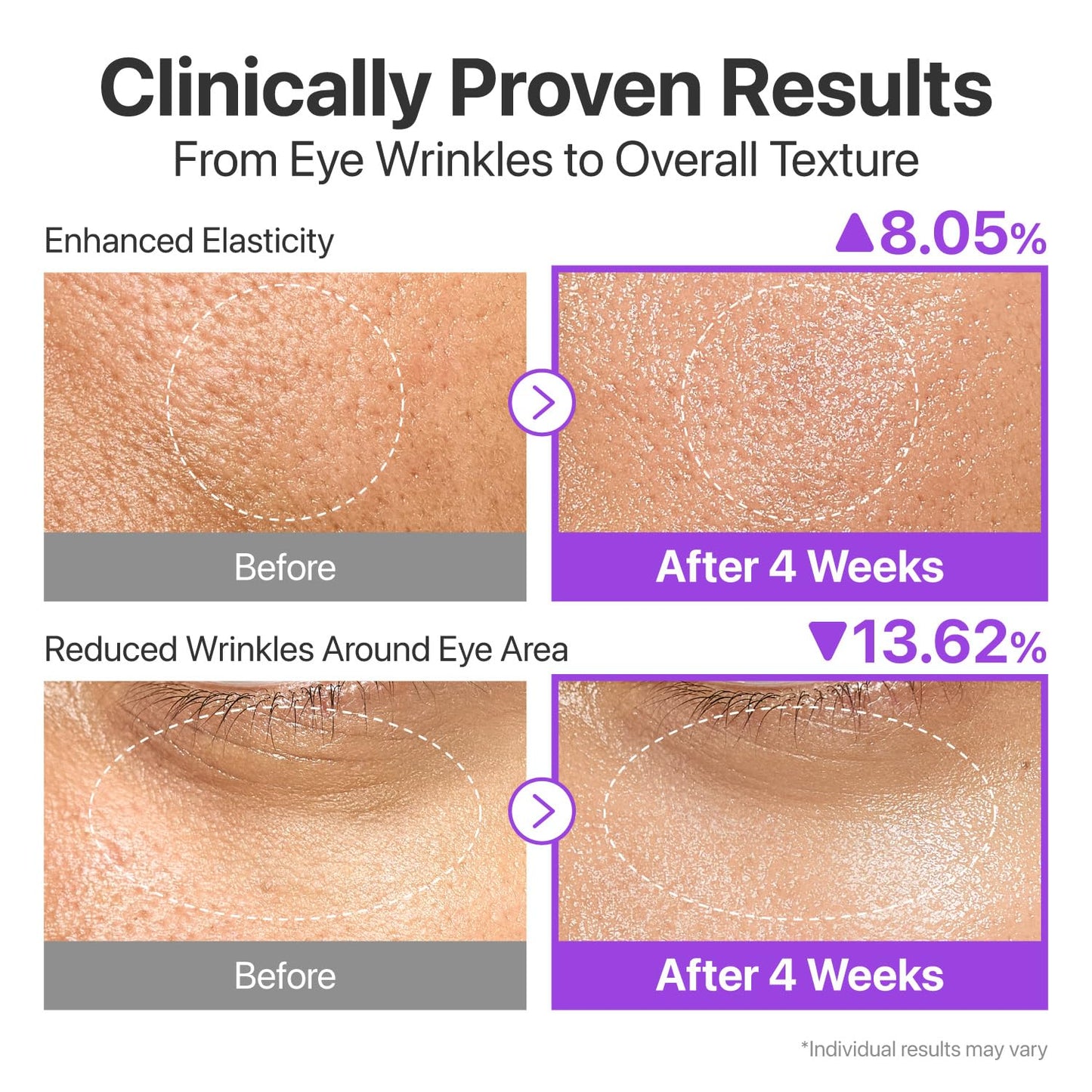 numbuzin No.9 Essence | NAD+ BIO Lifting-sil Essence | Firming, Reduce Wrinkles, Fine Lines | Peptides, NAD+ | Serum for Sagging, Aging, Dull Skin | 1.69 fl. oz. - Medaid International