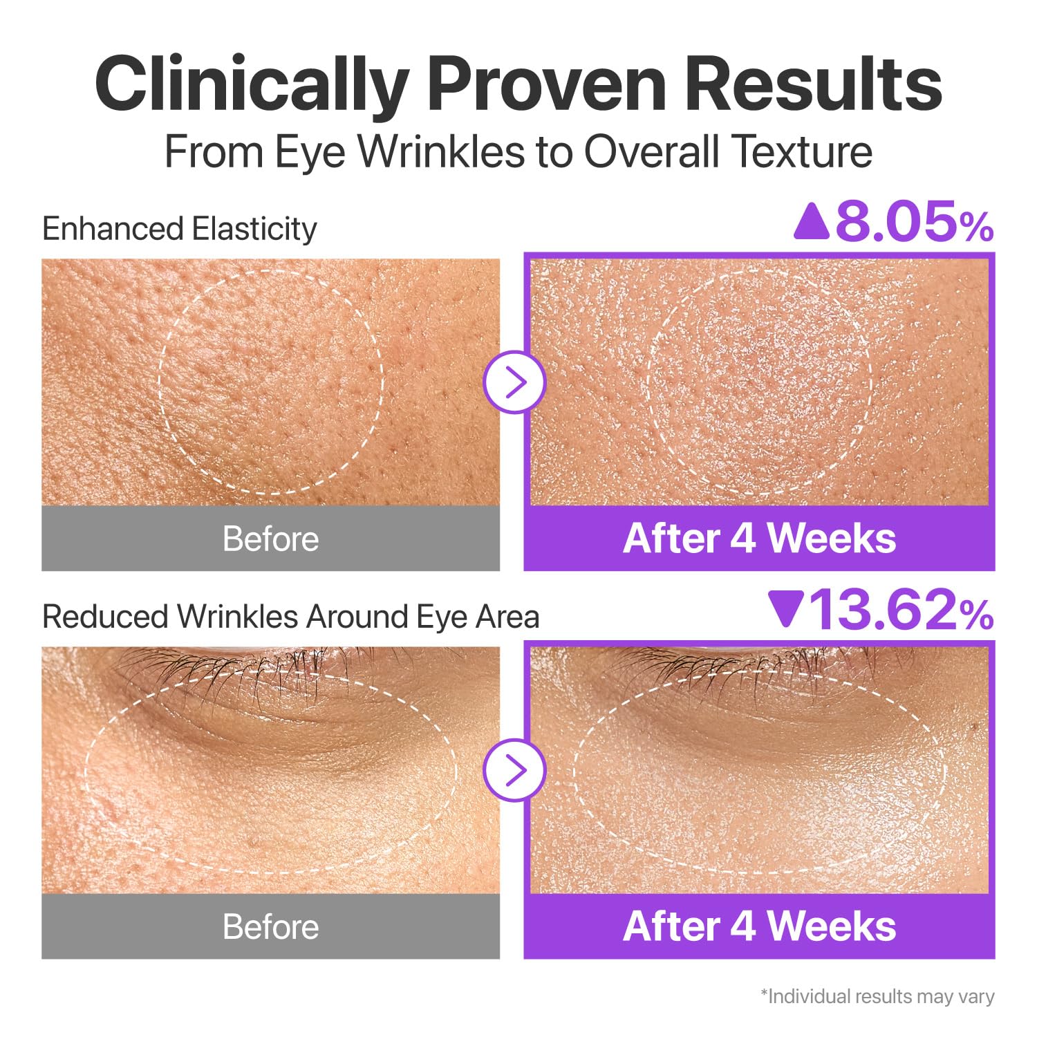 numbuzin No.9 Essence | NAD+ BIO Lifting-sil Essence | Firming, Reduce Wrinkles, Fine Lines | Peptides, NAD+ | Serum for Sagging, Aging, Dull Skin | 1.69 fl. oz. - Medaid International