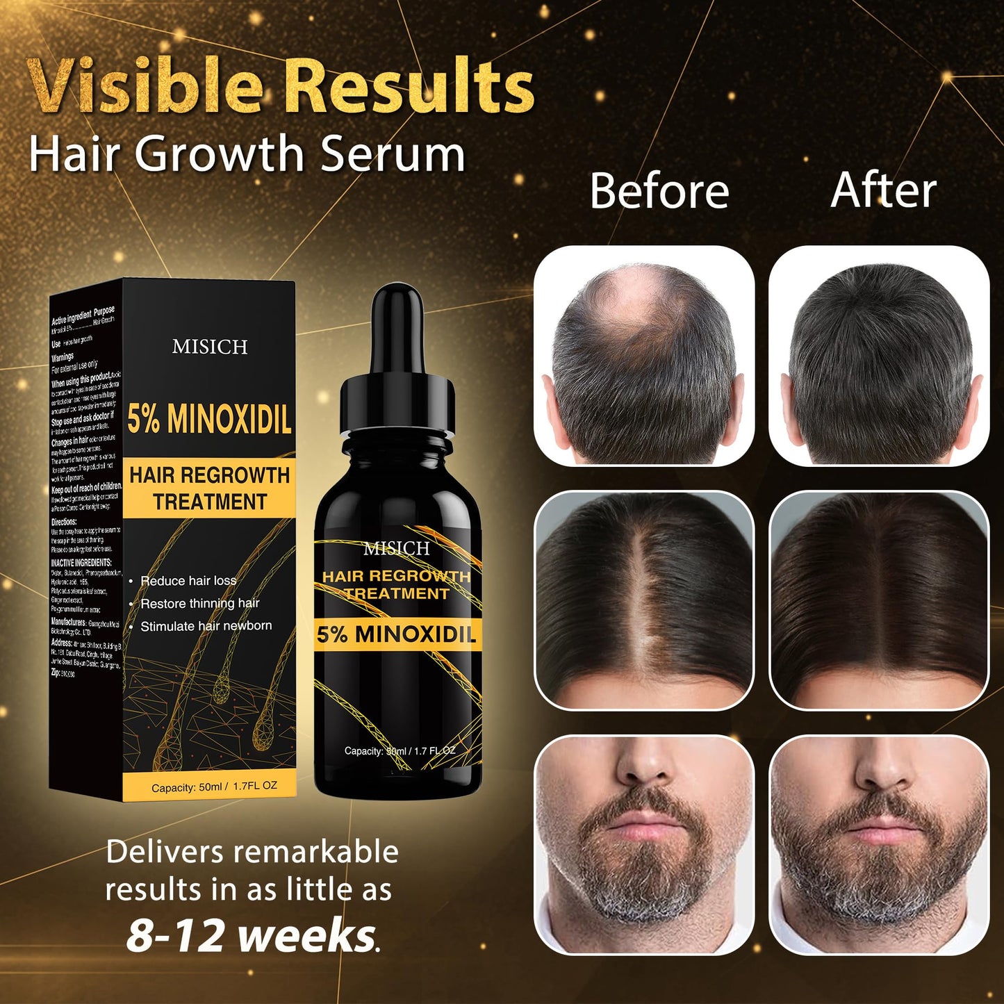 5% Minoxidil for Men and Women, Biotin Hair Growth Serum Oil, Natural Hair Loss Regrowth Treatment for Thicker, Fuller Hair 50ml - Medaid International