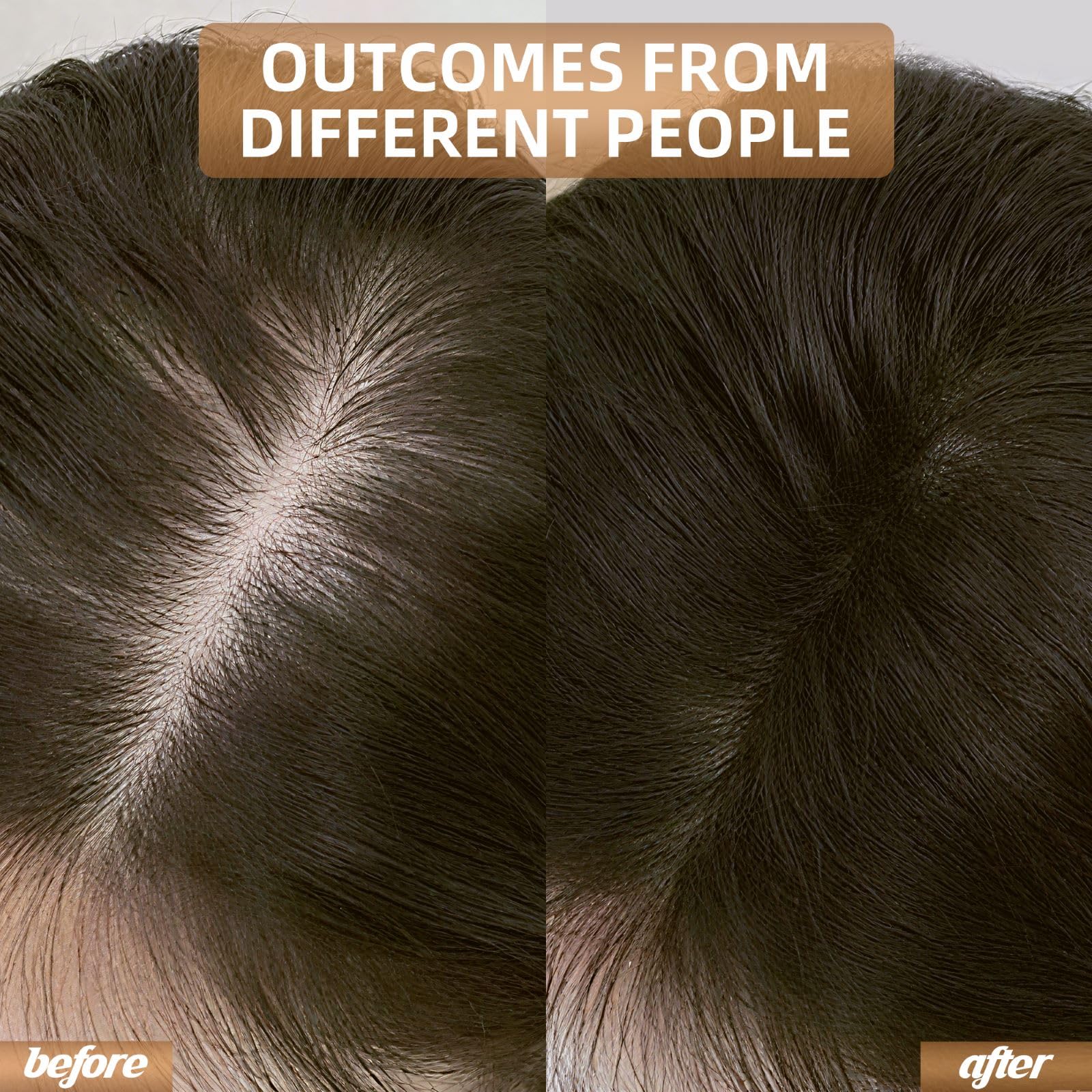 Red Light Therapy for Hair Growth, Cordless Hair Regrowth for Home & Travel, Laser Therapy Cap - Medaid International