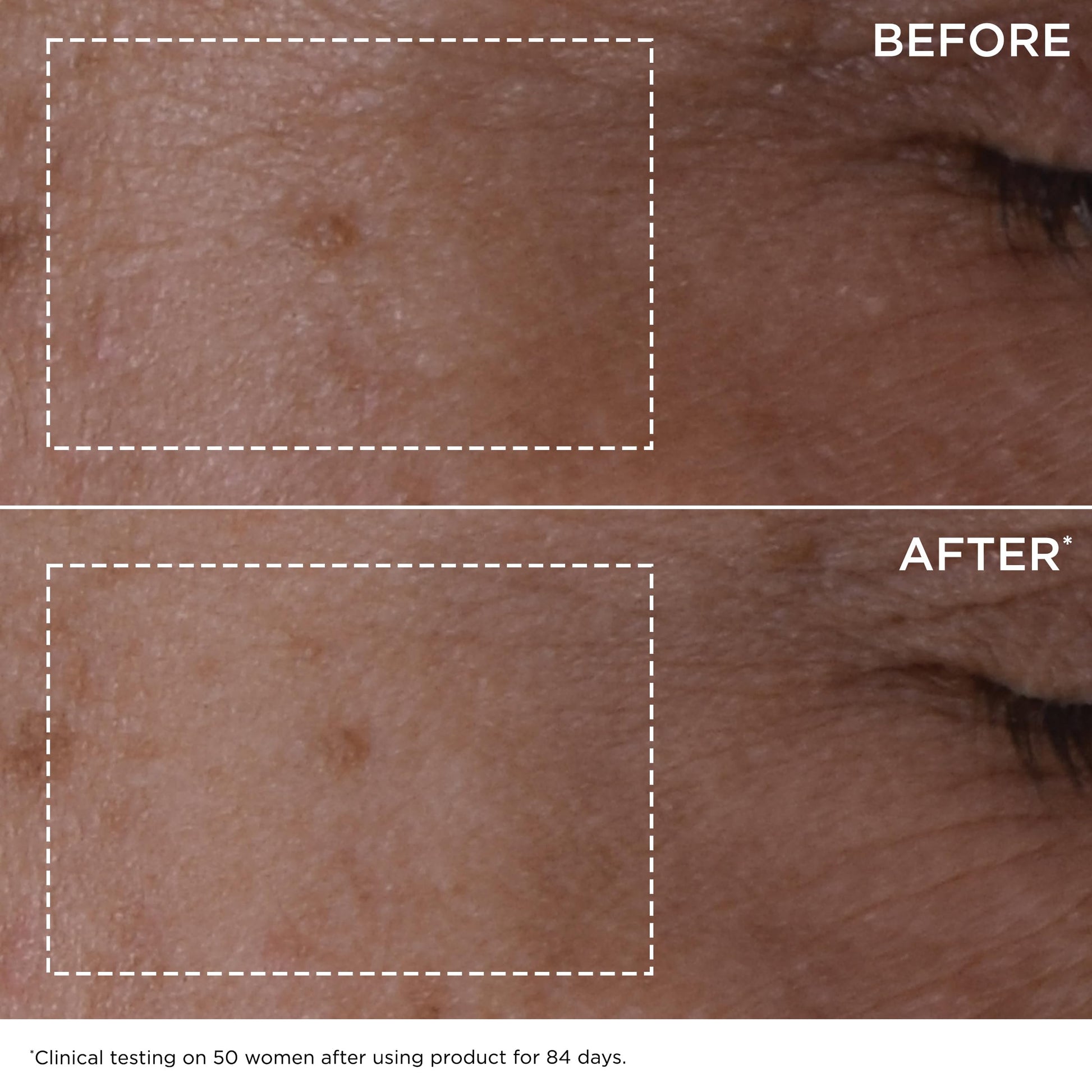 Clarins DOUBLE SERUM | Anti Aging Face Serum | Visibly Firms, Smoothes, Boosts Radiance, and Refines Pores | 24H Hydration | All Skin Types, 1 Fl Oz - Medaid International