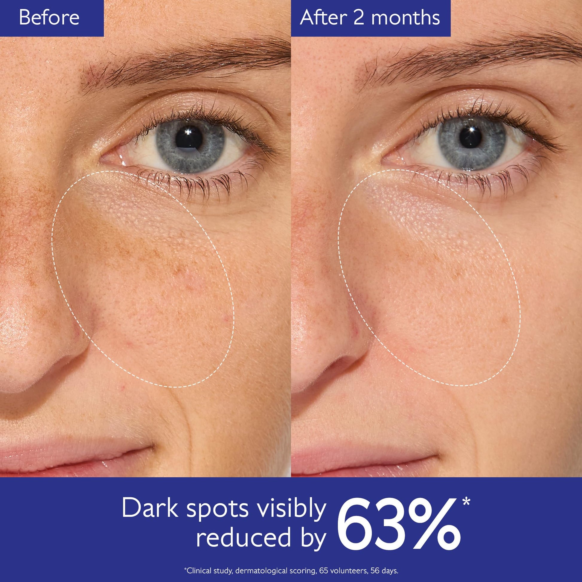 Caudalie Vinoperfect Brightening Dark Spot Serum Vitamin C Alternative - 62x More Effective than Vitamin C with Viniferine for a Visibly Brighter Even Complexion, 30 mL - Medaid International