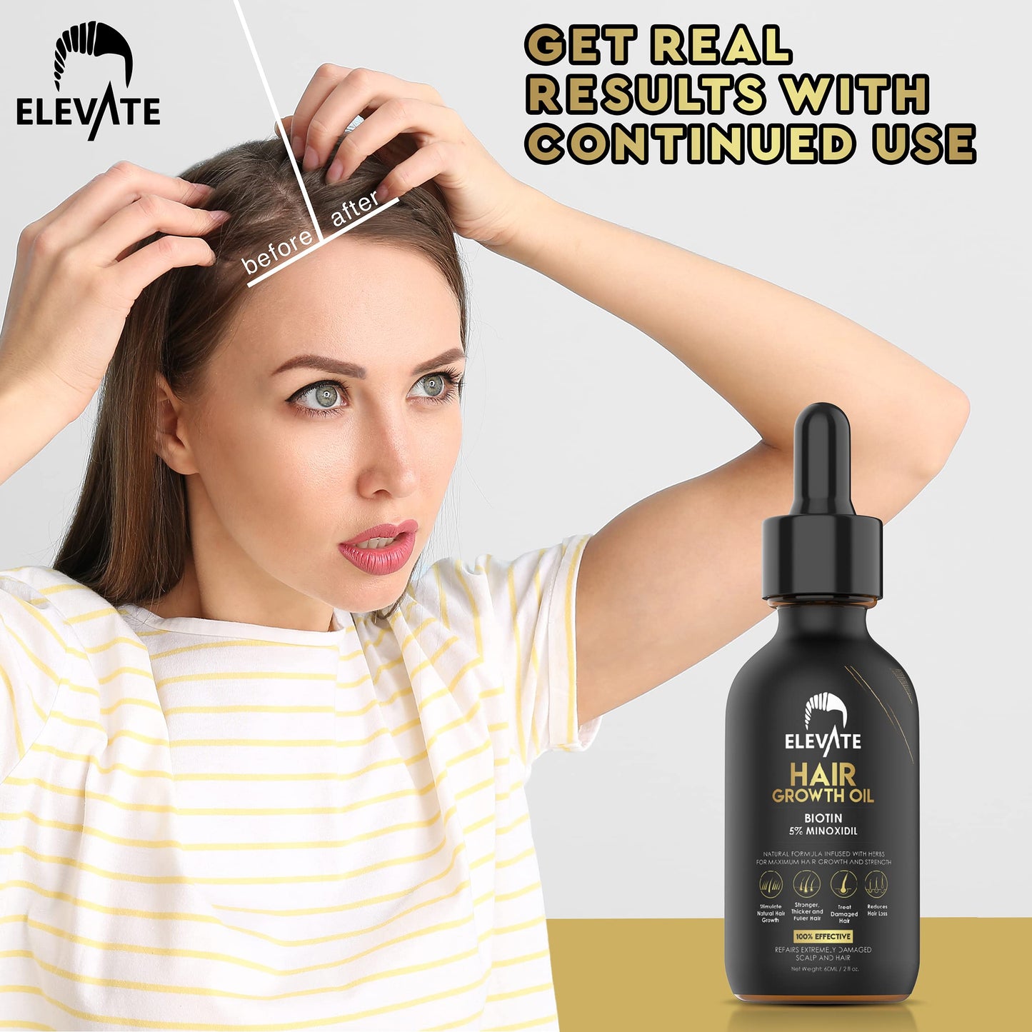 Elevate Hair Regrowth Treatment 5% Minoxidil Solution - Biotin Serum Hair Growth Oil for Men & Women - Thicker Fuller Stronger Hair - Stops Hair Loss & Thinning - Natural Hair Thickening Treatment 1oz - Medaid International