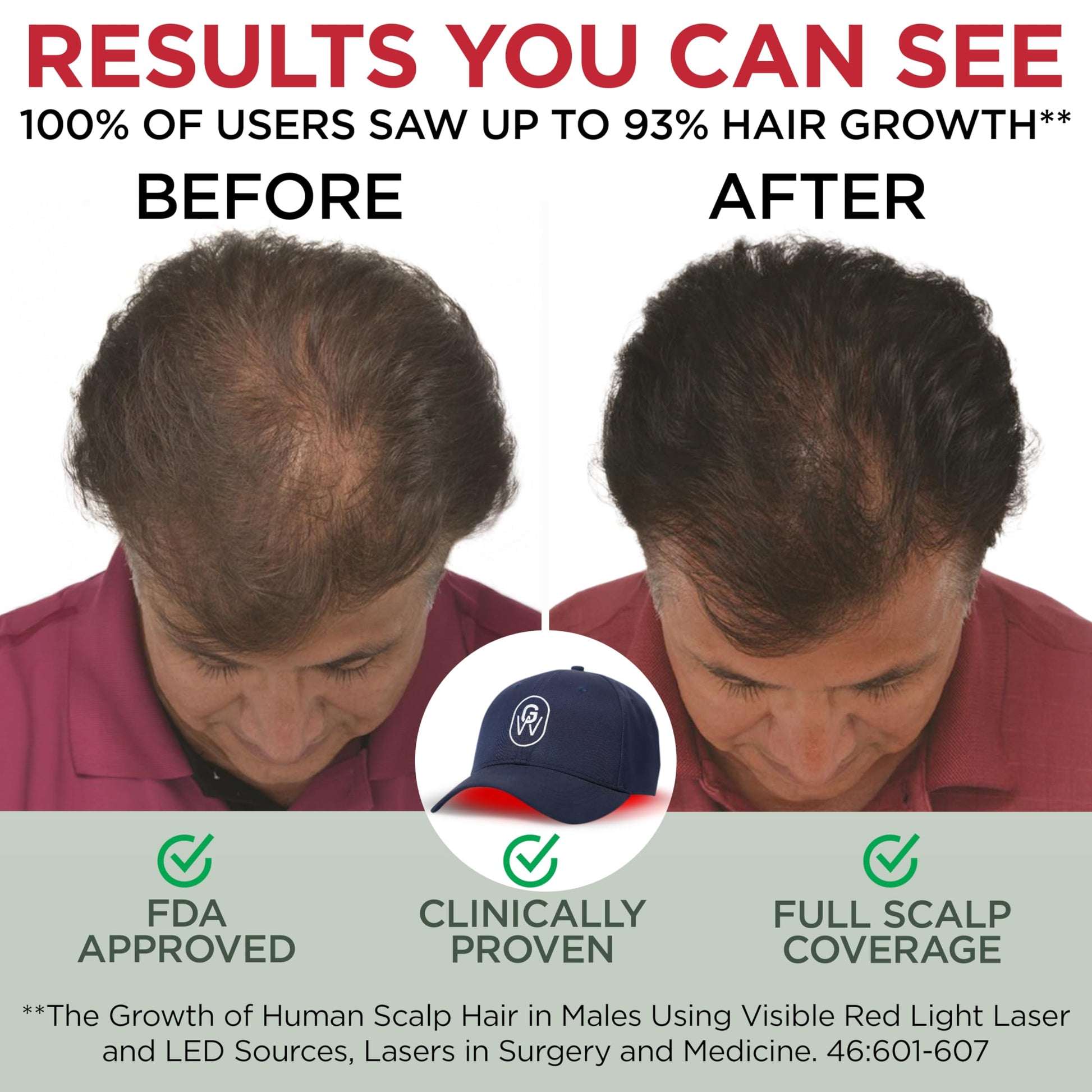 GroWell Red Light Therapy Hair Growth Cap – FDA Cleared Laser Treatment for Hair Regrowth and Reduced Shedding – LED & Laser Red Light Therapy Clinically Proven in Double-Blind Studies - Blue - Medaid International