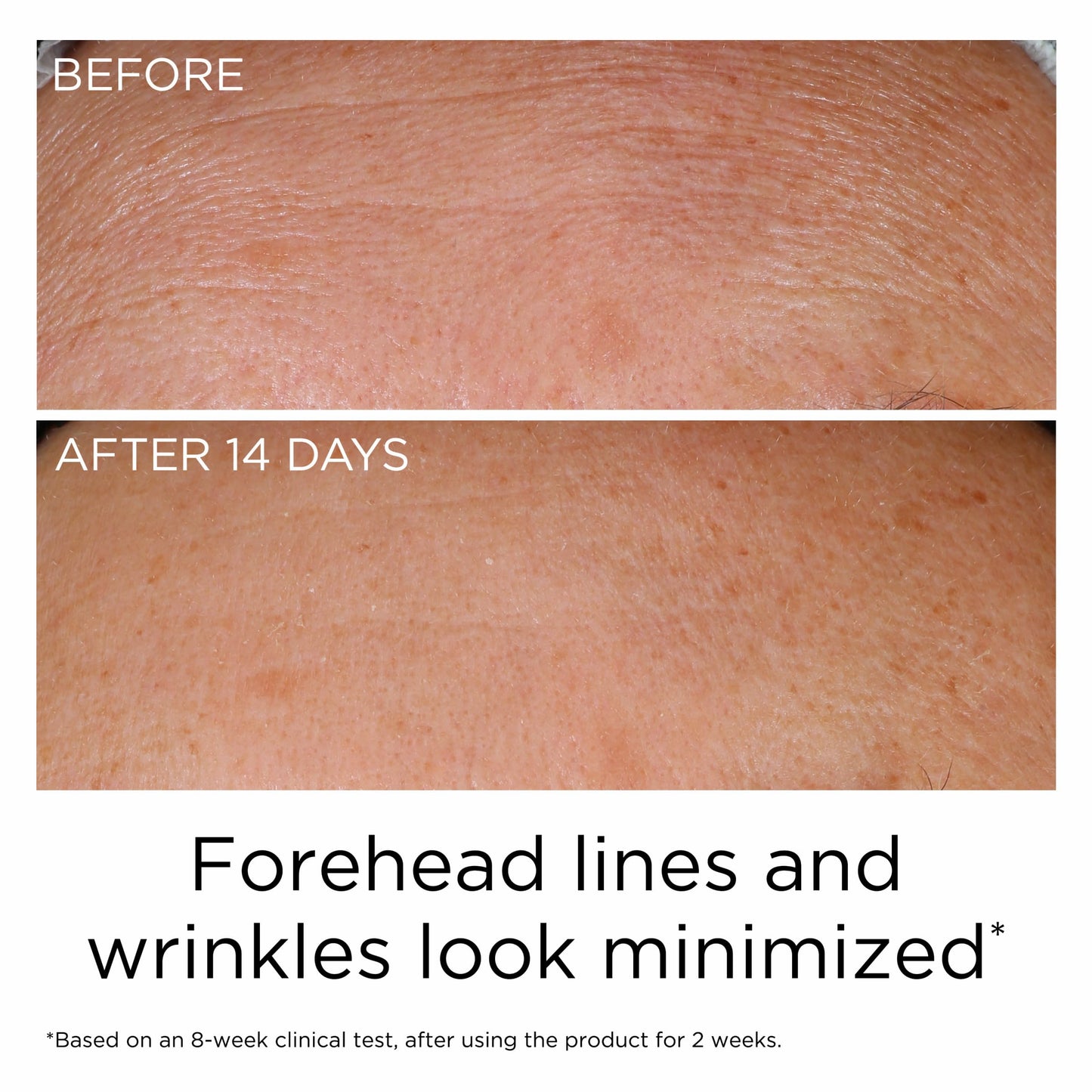 Elizabeth Arden PREVAGE Anti-Aging Face Serum 2.0 for Women, Brightening & Dark Spot Correcting Skincare, With Antioxidant Idebenone Technology, 1.7 Fl Oz - Medaid International