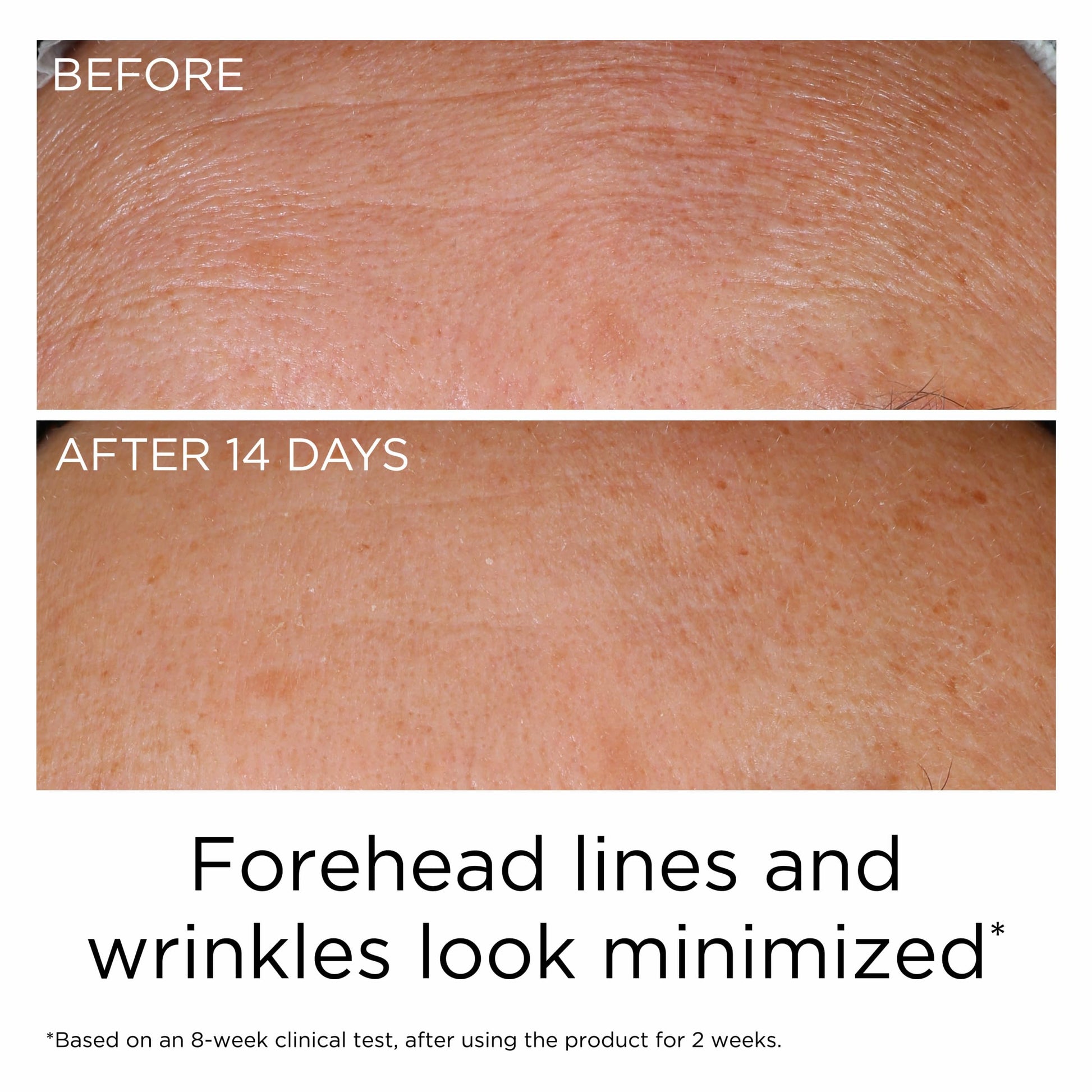 Elizabeth Arden PREVAGE Anti-Aging Face Serum 2.0 for Women, Brightening & Dark Spot Correcting Skincare, With Antioxidant Idebenone Technology, 1.7 Fl Oz - Medaid International