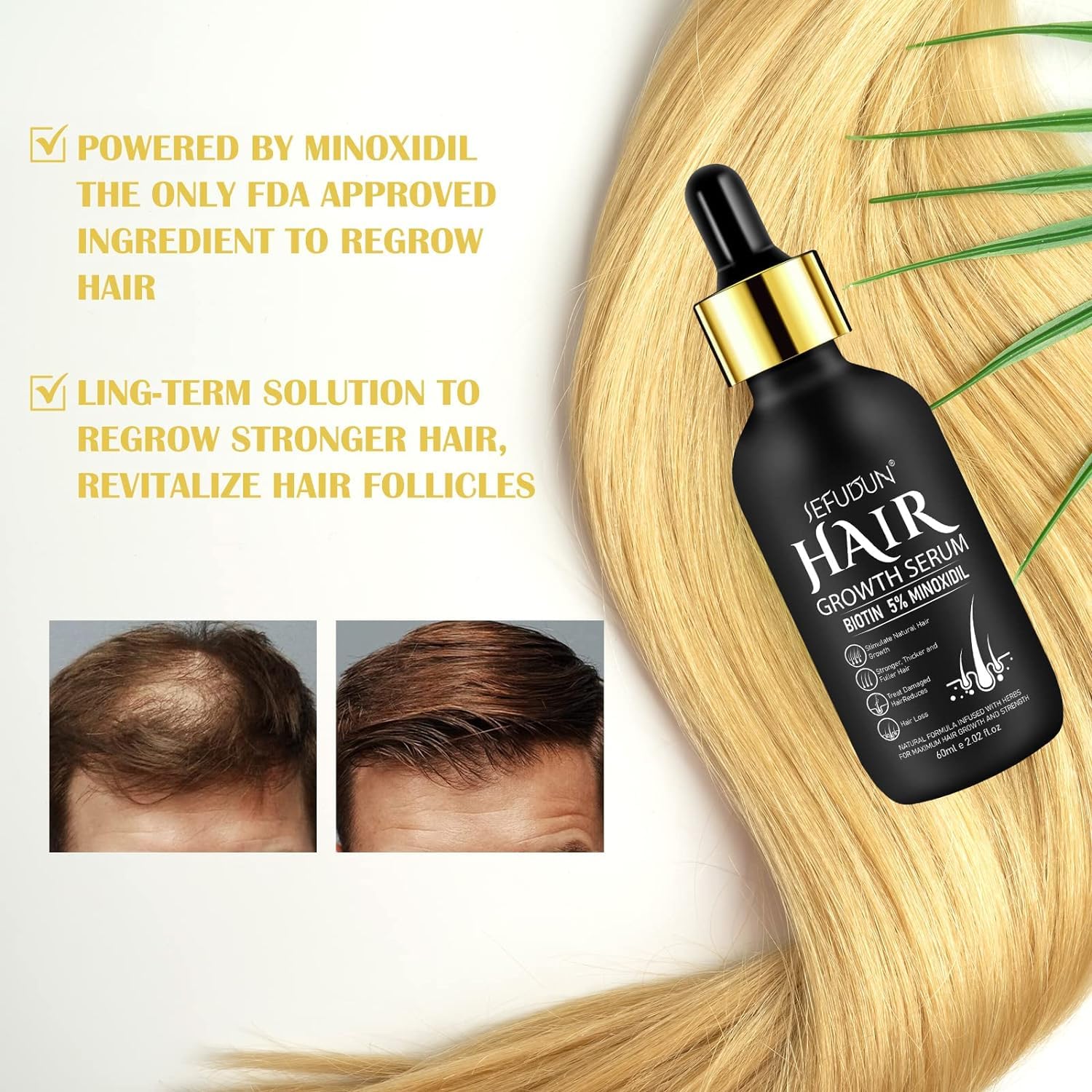 5% Minoxidil for Men and Women Hair Growth Oil, Minoxidil Hair Growth Serum Infused with Biotin for Hair Regrowth Treatment, Scalp Hair Loss Hair Thinning, Natural Hair Growth 2.02 oz - Medaid International