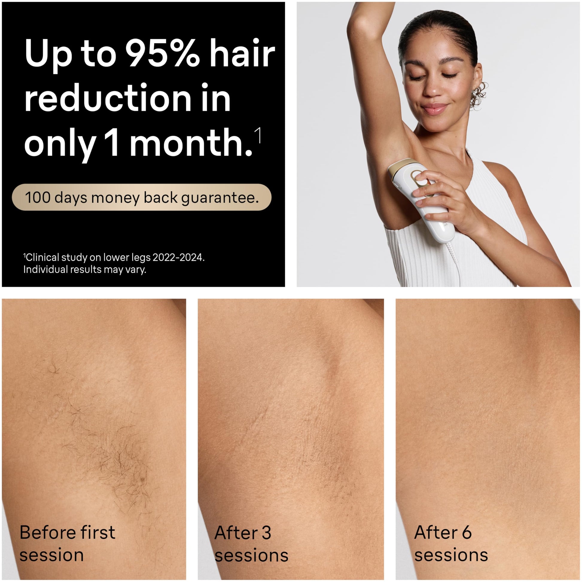 Braun IPL at Home Laser Hair Removal for Women and Men, Silk Expert Pro 5 PL5137 with Venus Swirl Razor, Permanent Visible Hair Reduction in Hair Regrowth for Body & Face, Corded, PL5137 - Medaid International