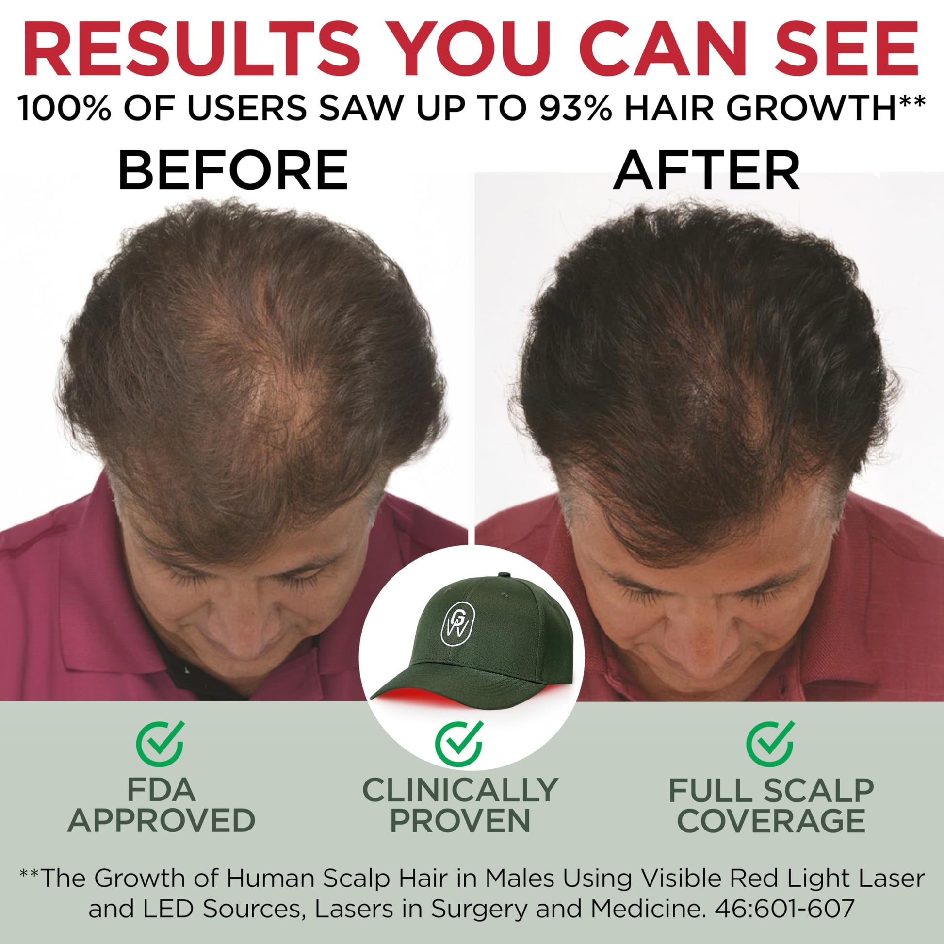 GroWell Red Light Therapy Hair Growth Cap – FDA Cleared Laser Treatment for Hair Regrowth and Reduced Shedding – LED & Laser Red Light Therapy Clinically Proven in Double-Blind Studies -Green - Medaid International
