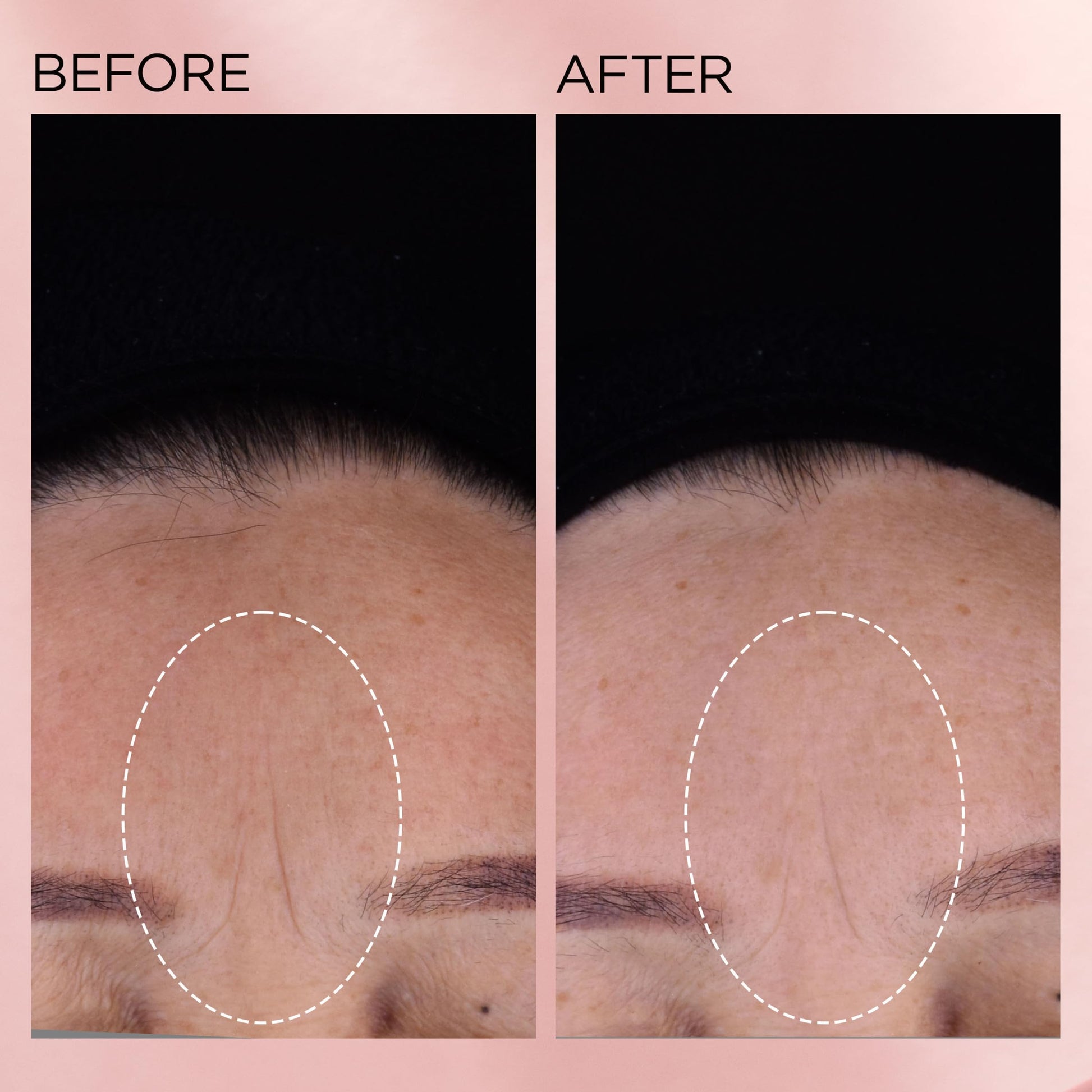 Elizabeth Arden Retinol + HPR Ceramide Rapid Skin Renewing Anti-Aging Face Serum Capsules, Fine Lines & Wrinkles Treatment with Peptides, Vitamin E, & Niacinamide, 60 Count - Medaid International