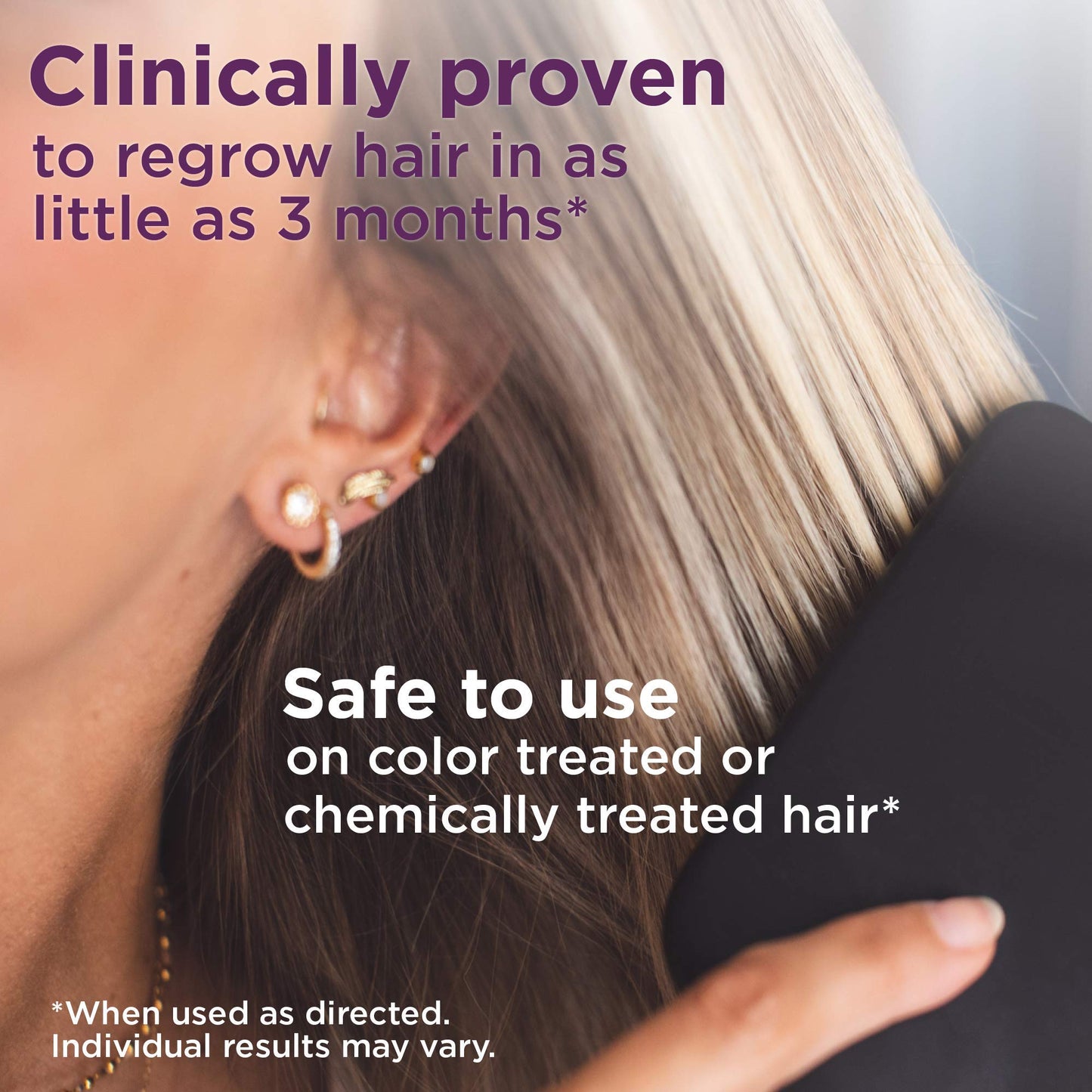 Amazon Basic Care Hair Regrowth Treatment For Women, Minoxidil 5% Topical Aerosol (Foam), 12 Month Supply, Unscented, 2.11 ounce (Pack of 6) - Medaid International