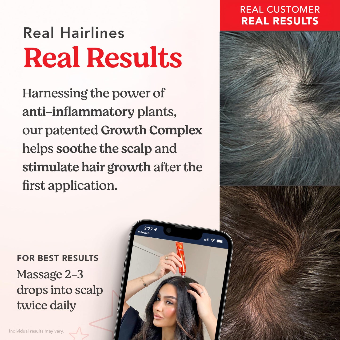 HAIRtamin Scalp Serum | Visibly Thicker, Nourished Hair and Healthy Scalp Treatment (Two Pack) - Medaid International