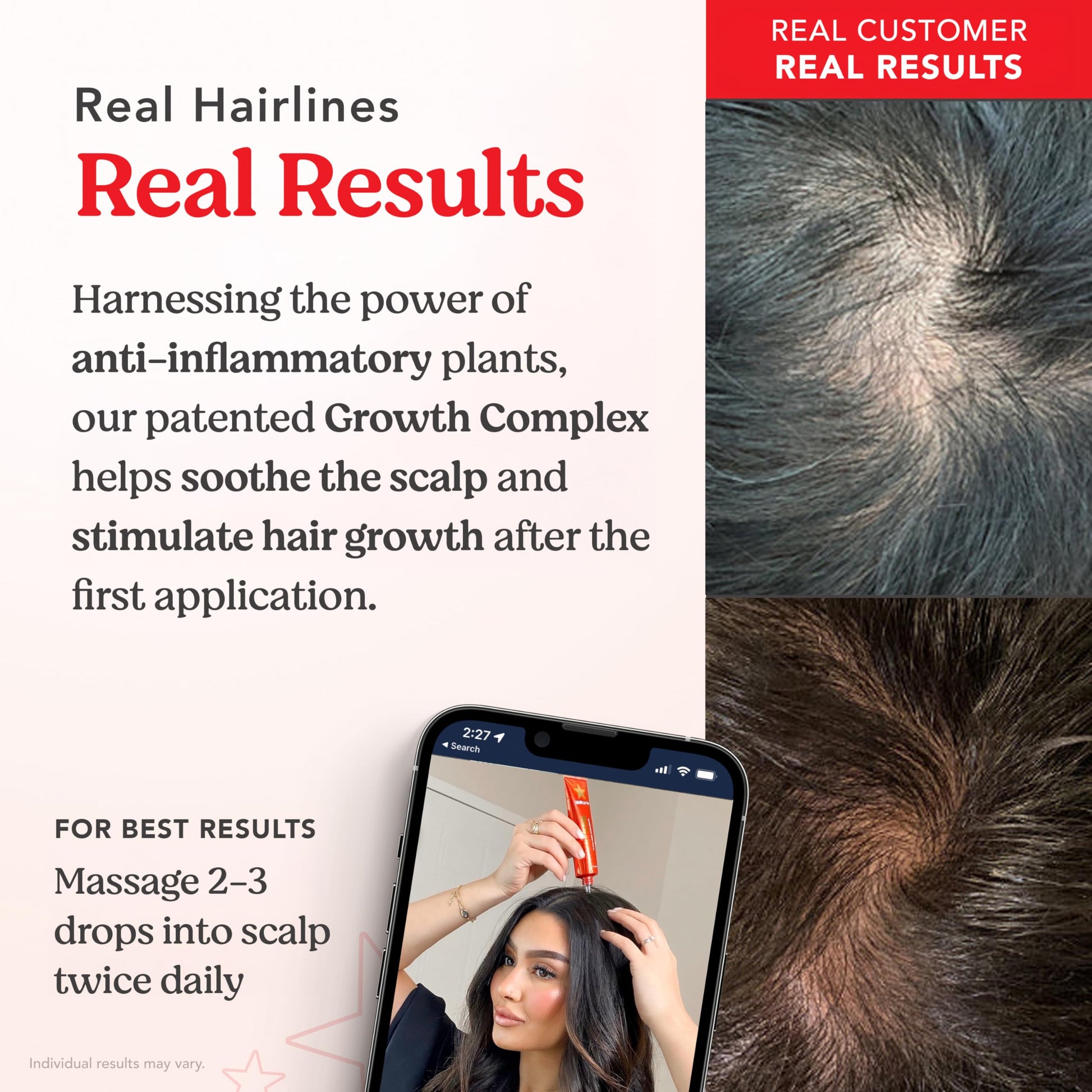 HAIRtamin Scalp Serum | Visibly Thicker, Nourished Hair and Healthy Scalp Treatment (Two Pack) - Medaid International