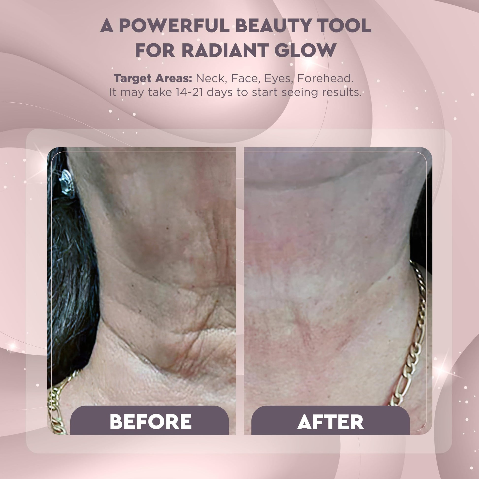 GLO24K Red Light Face & Neck Beauty Device – 3-in-1 Facial Massager Tool with LED & Vibration for Skin Revitalization and Neck Firming - Medaid International