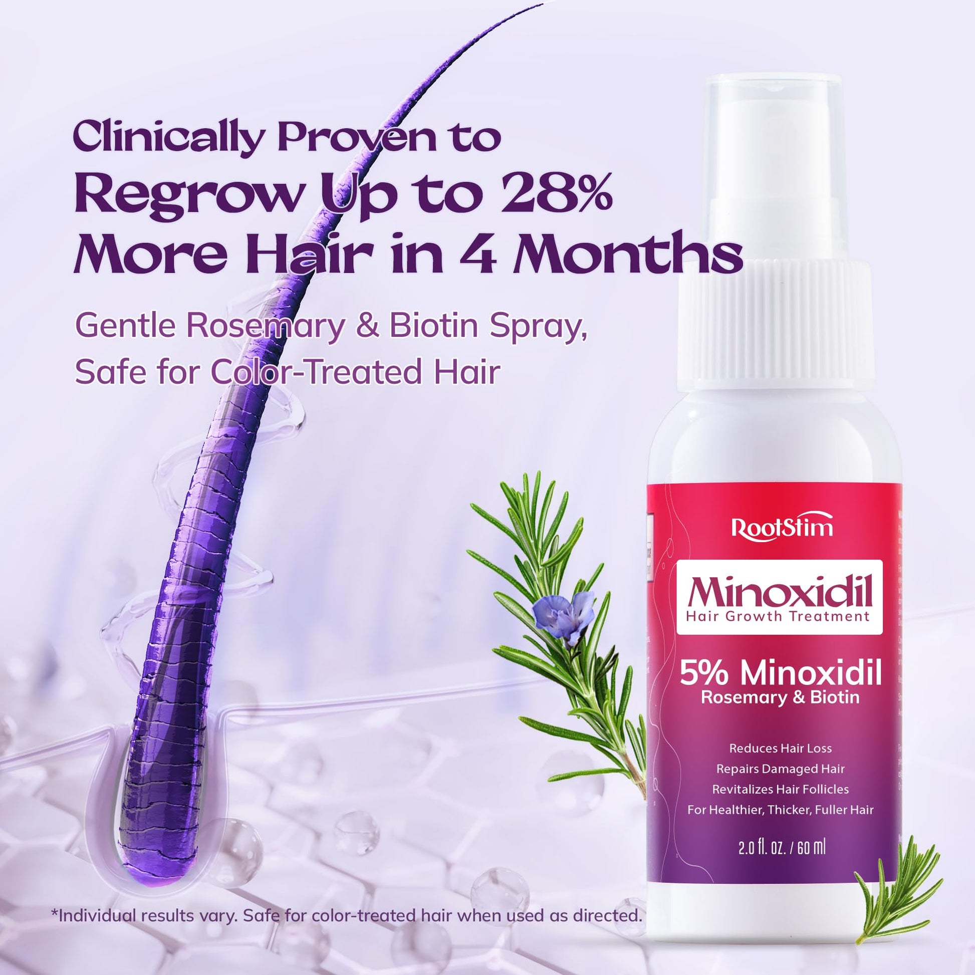 Women's 5% Minoxidil Spray for Hair Growth: RootStim Extra Strength Minoxidil with Rosemary & Biotin for Thinning Hair Regrowth and Fuller Hair 60 ML - Medaid International