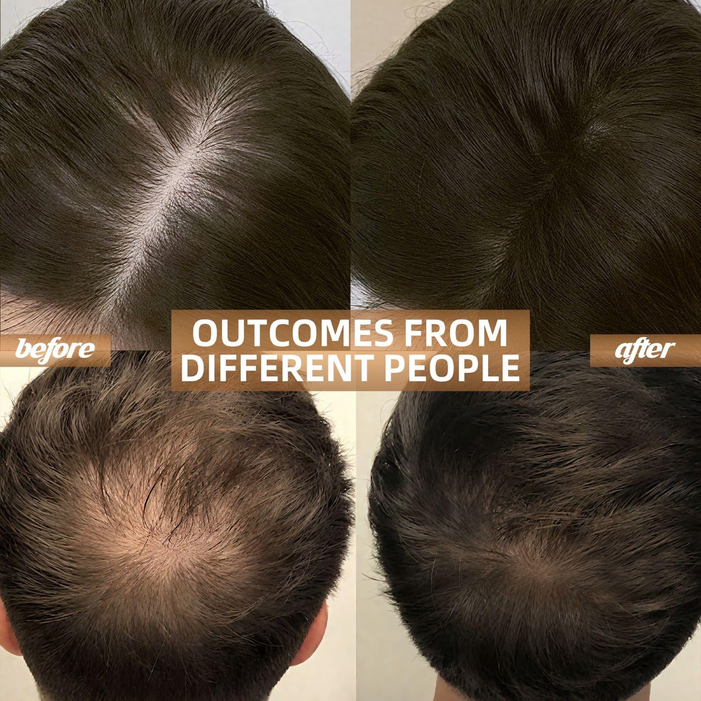 Red Light Therapy for Hair Growth with Built-in Battery & Controller - Medaid International