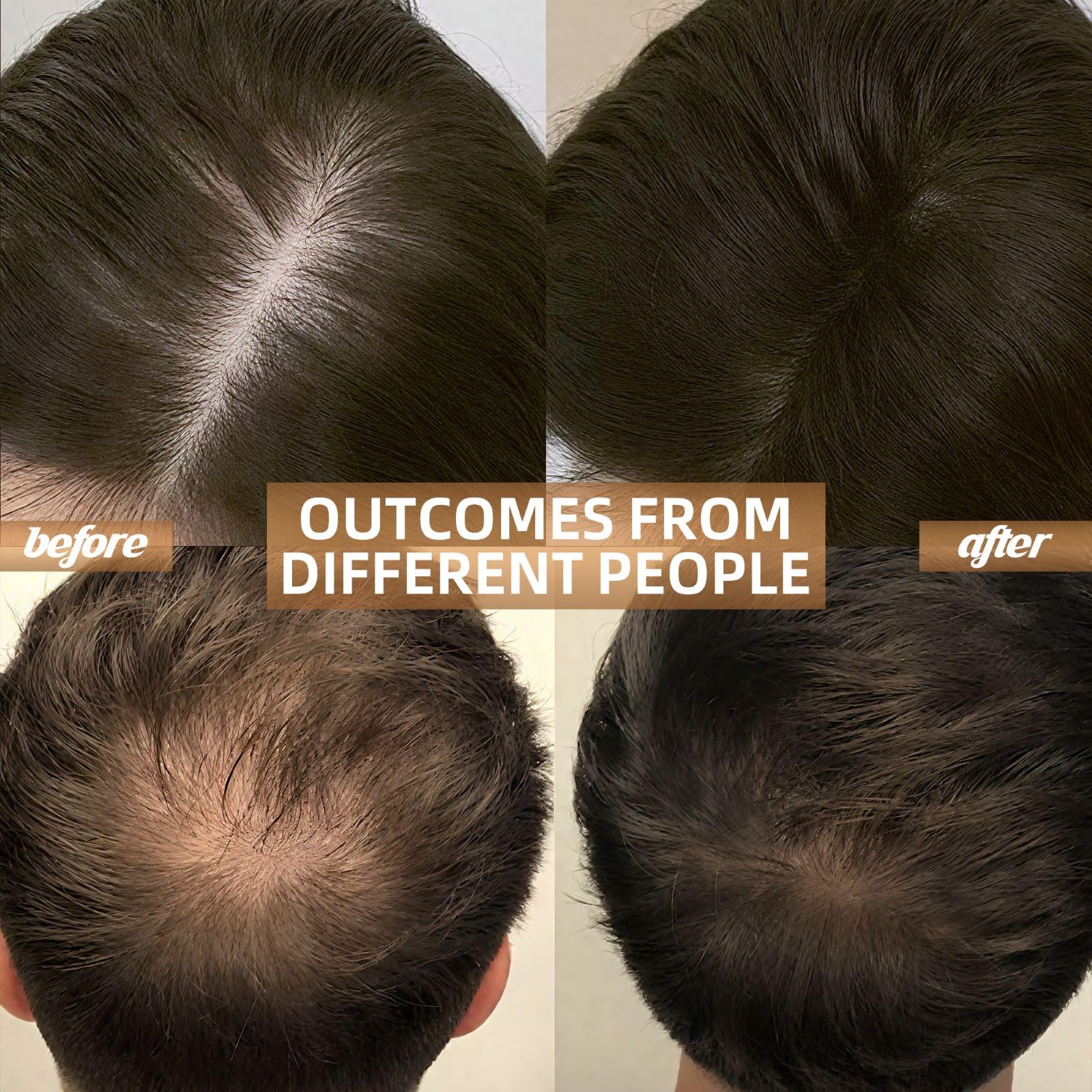 Red Light Therapy for Hair Growth with Built-in Battery & Controller - Medaid International