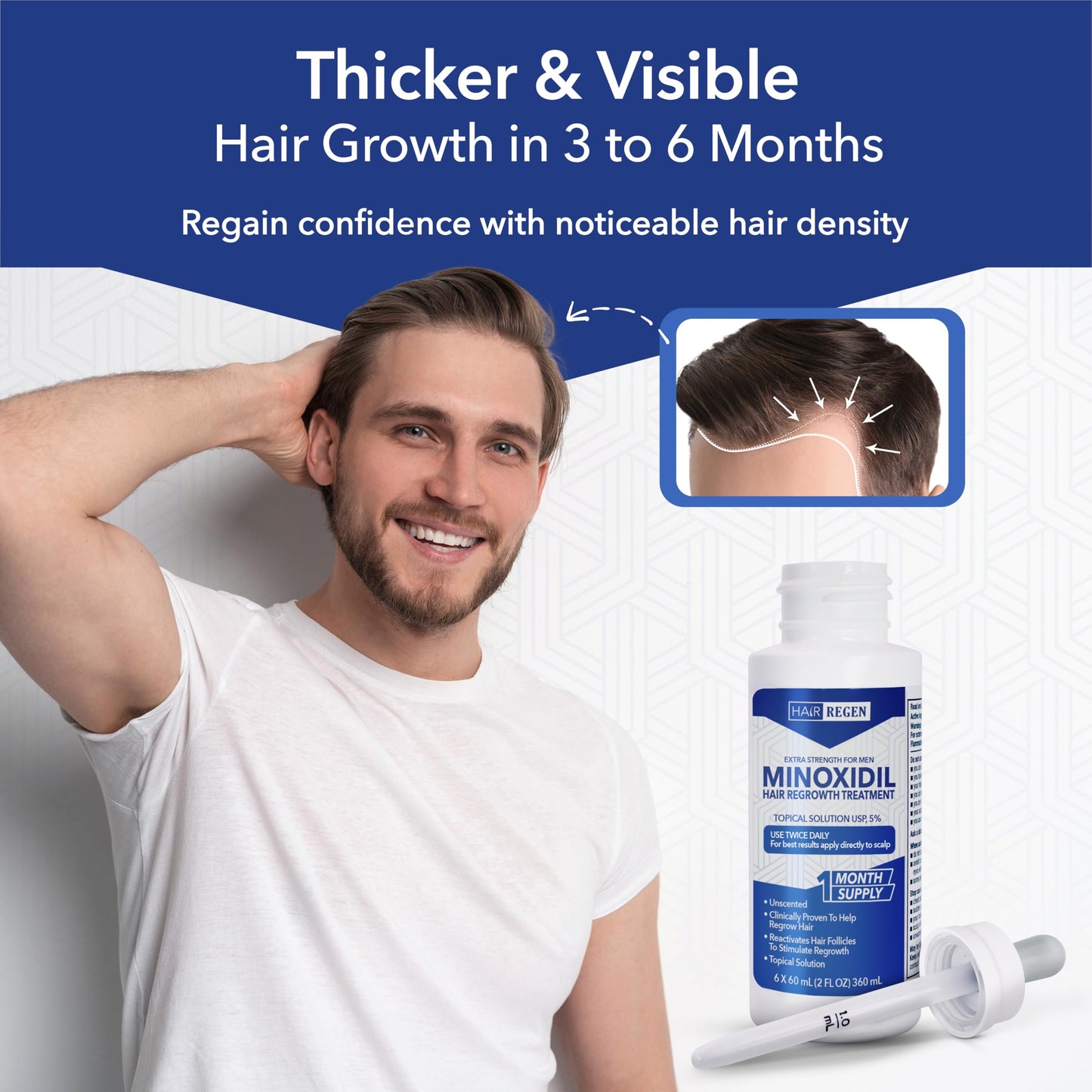 Hair-Regen Advanced 5% Minoxidil For Men Hair Regrowth Treatment for Thinning Hair - Hair Loss for Men - 6 Month Supply, Minoxidil Topical Solution So Thicker Fuller Hair Keeps Growing Amazing Results - Medaid International